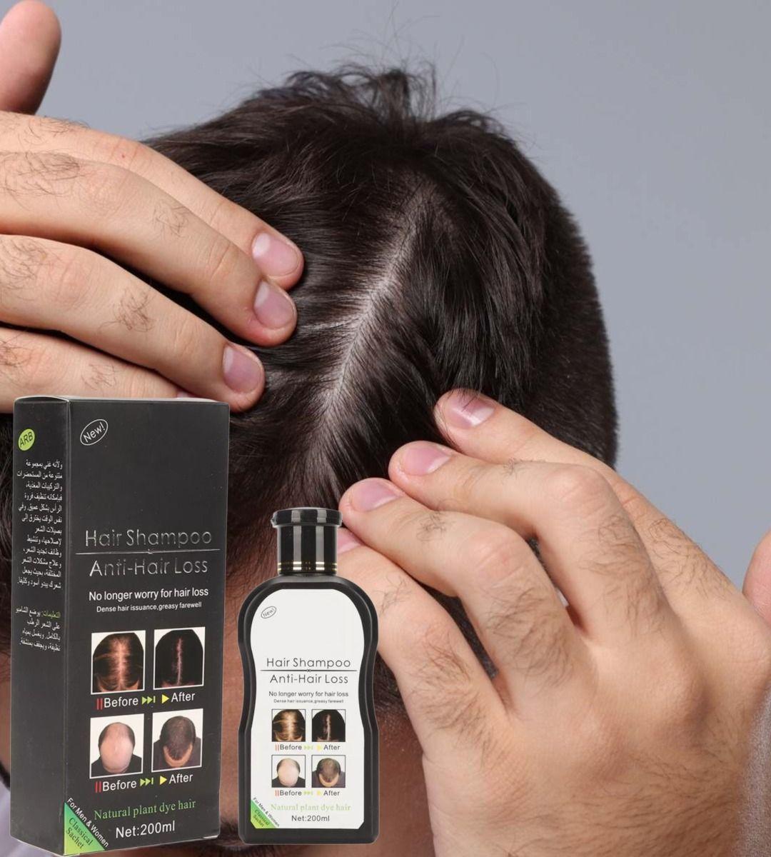 Set 2 Shampoo Anticaida Cabello Crecimiento Voluminoso Jhn-6