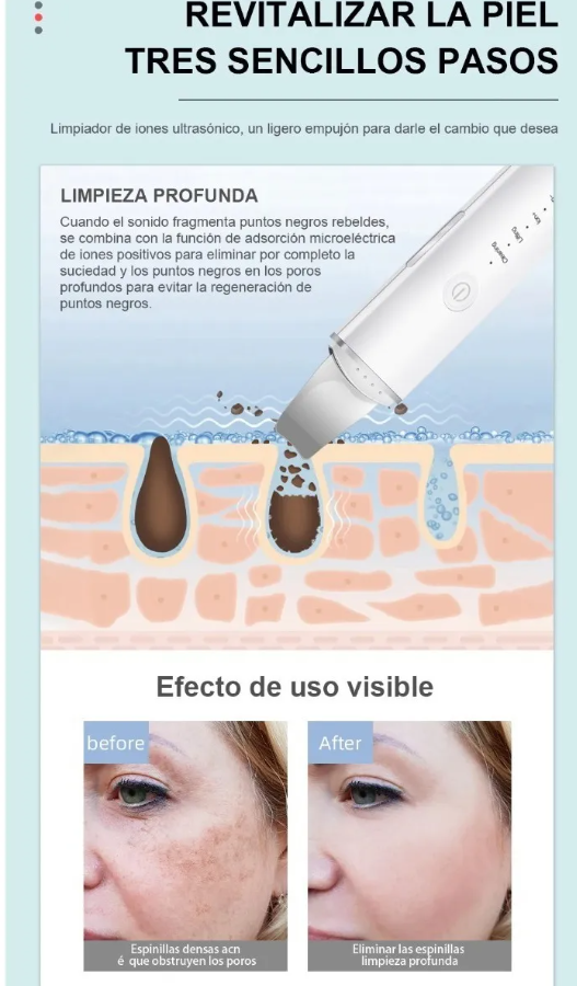 Espátula Facial Ultrasónica C/vibración, Peeling Facial.-6