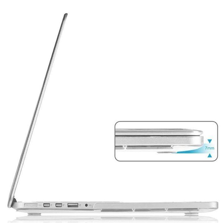 Carcasa Para MacBook Pro de 15.4" con pantalla Retina A1398-2