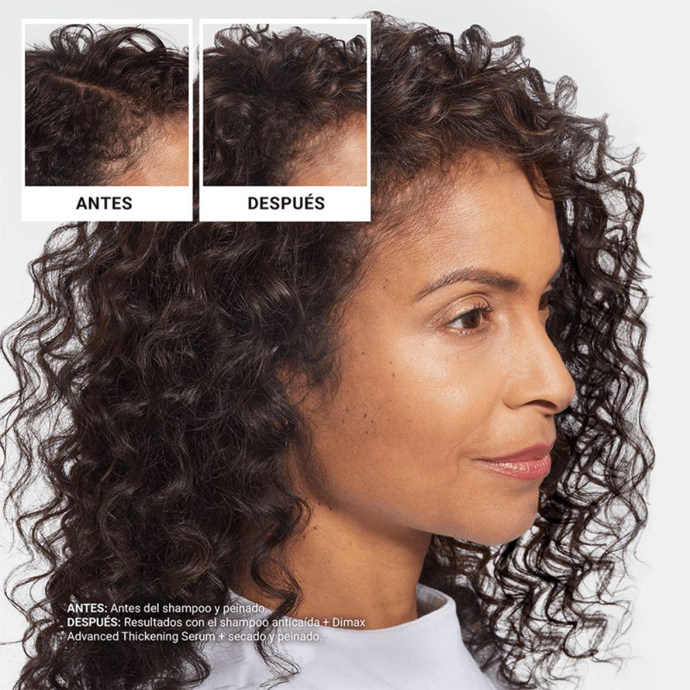 Nioxin Serum Anti-Hair Loss 70ml-4