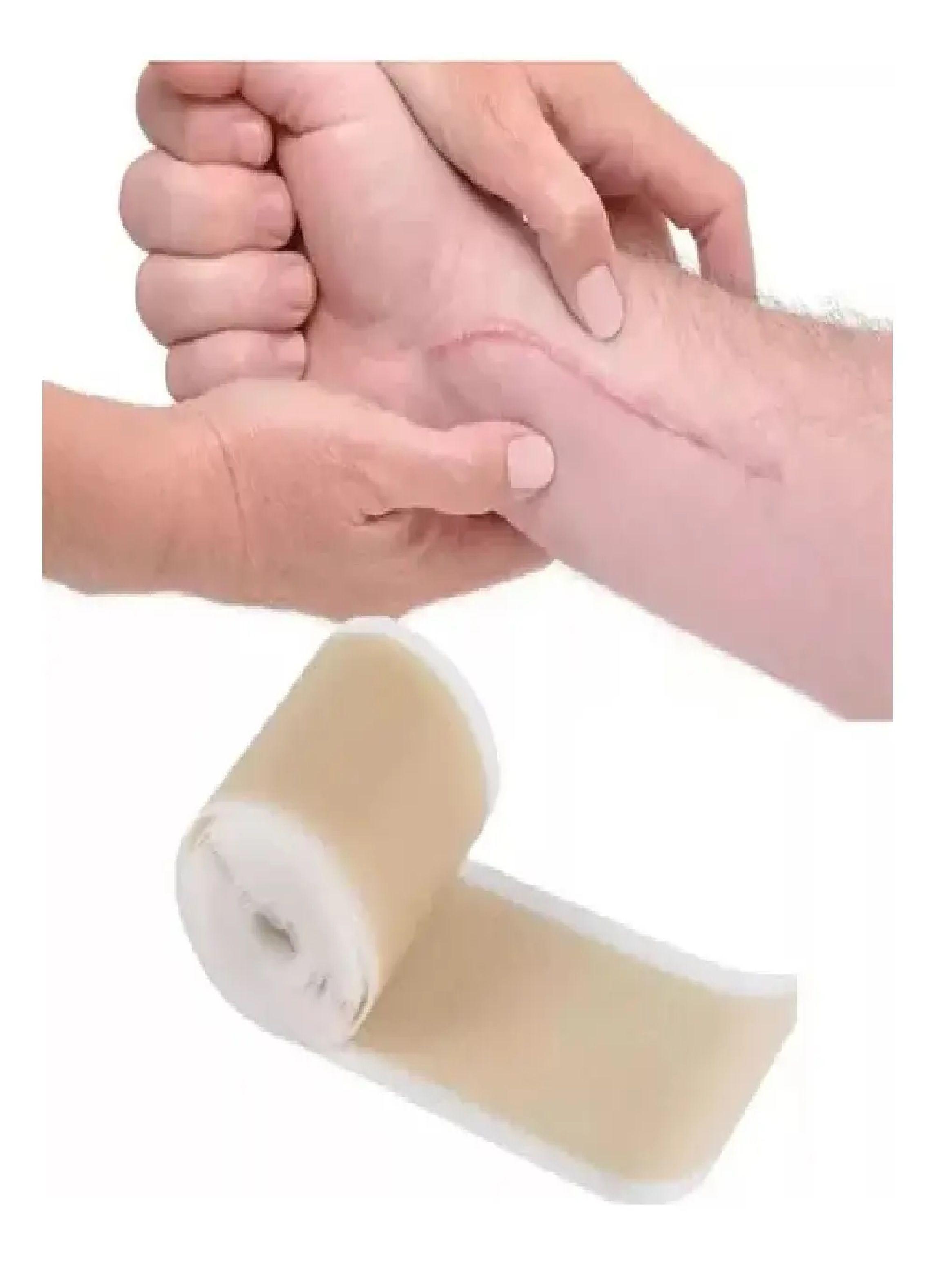 Parche Para Cicatrices Queloides Gel Rollo De 4cmx1m Heridas-4