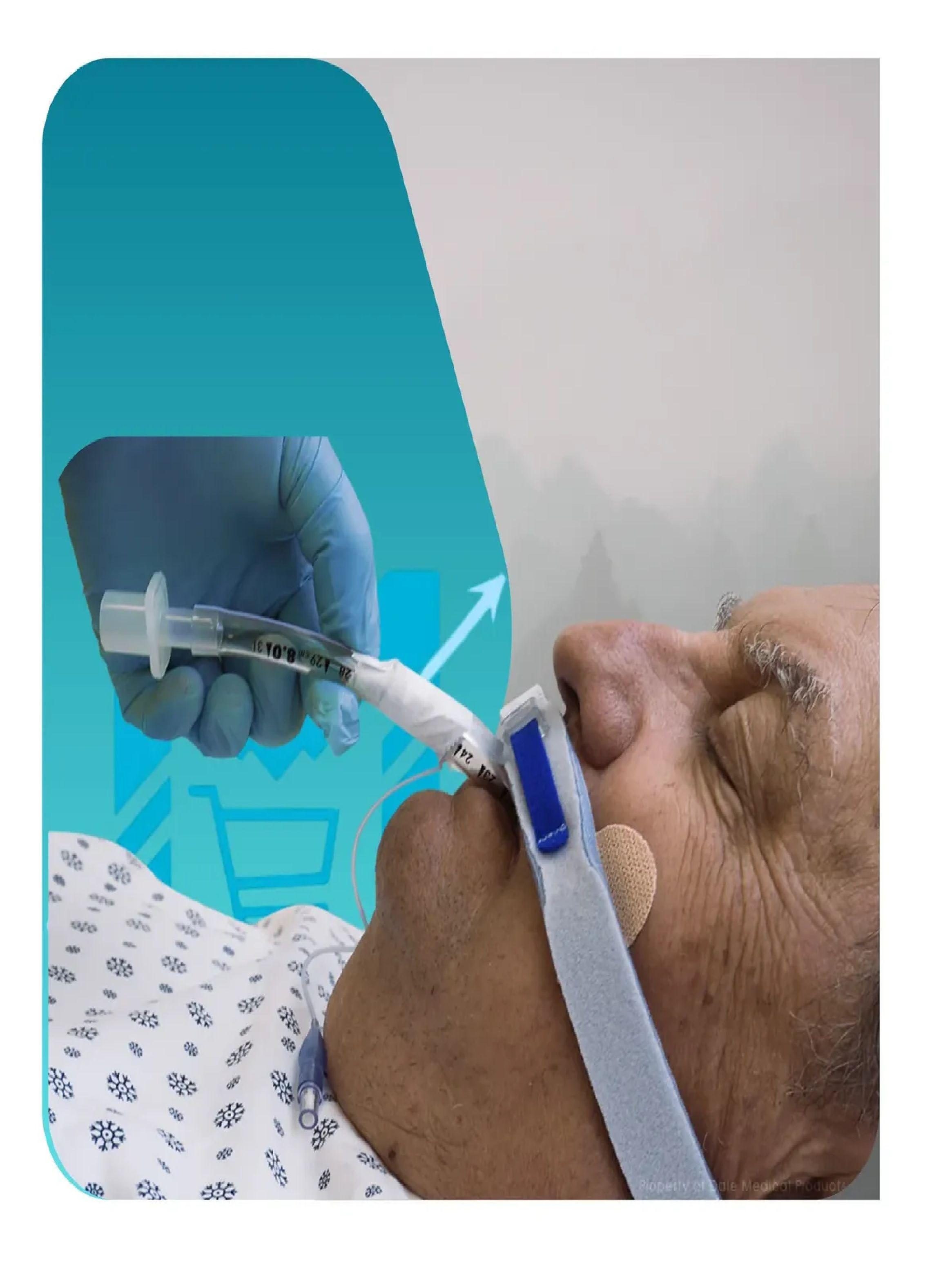 Tubo Endotraqueal Sin Balon Cranberry 5mm-3