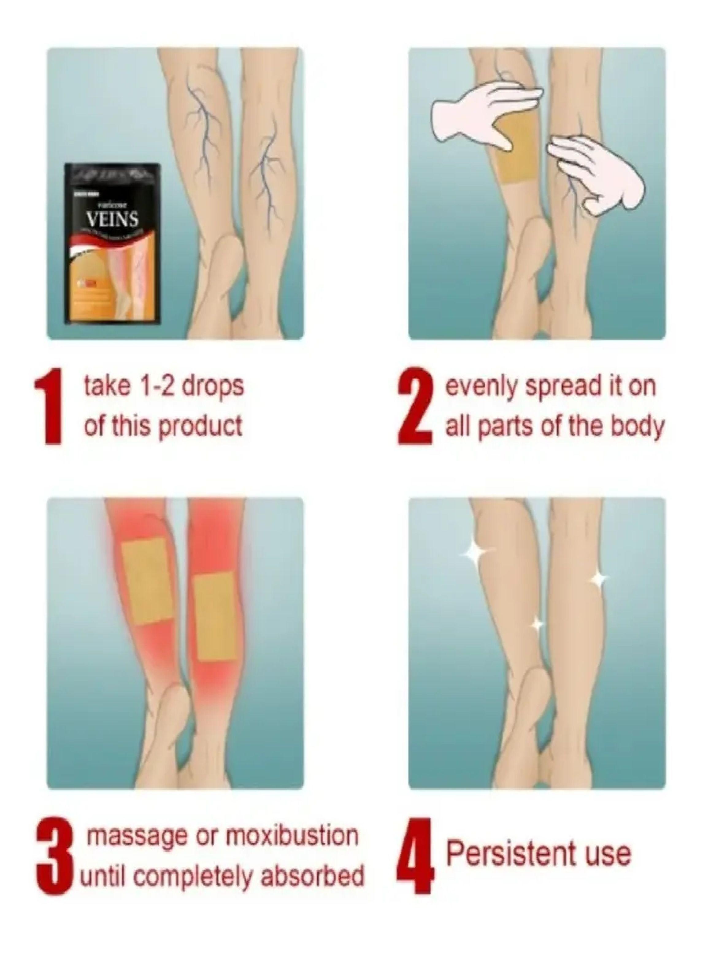24 Parches Para Tratamiento De Venas Varicosas Varices-3