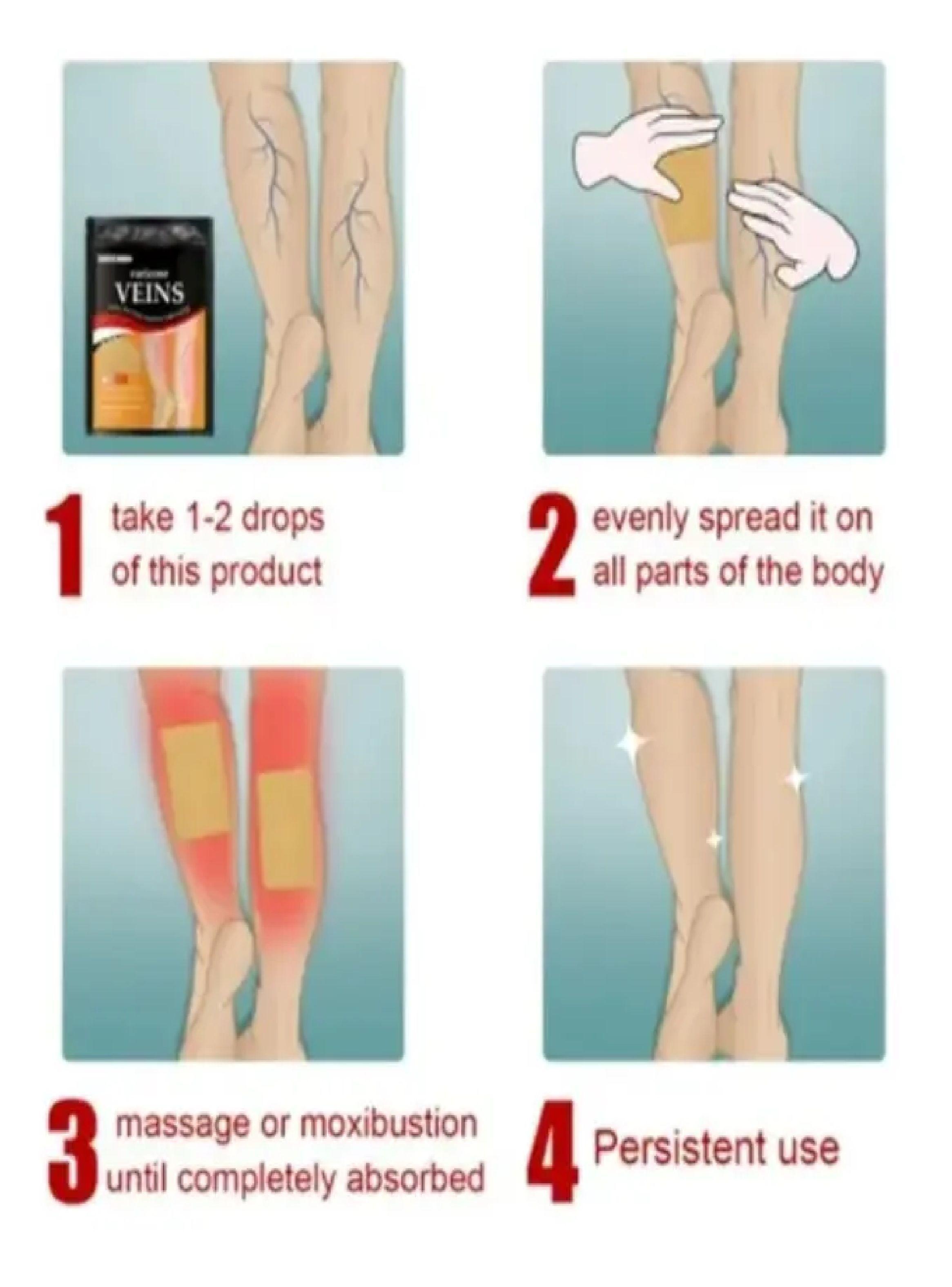 Medias Antiembolica Trombosis Venosa Parche Varices-3