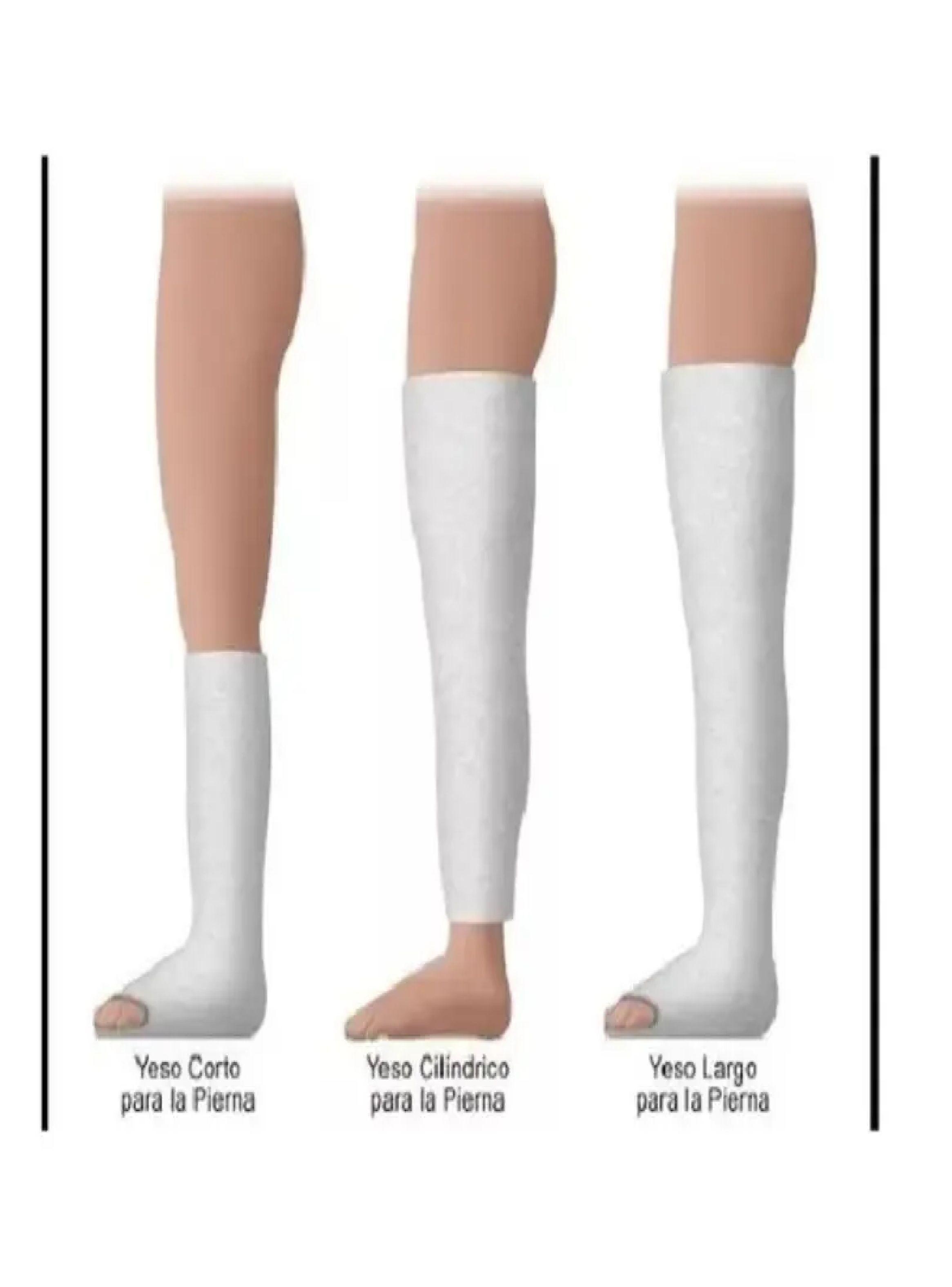 Venda De Yeso 15cm X 3mt Yesoterapia Lesiones Manualidaes-1