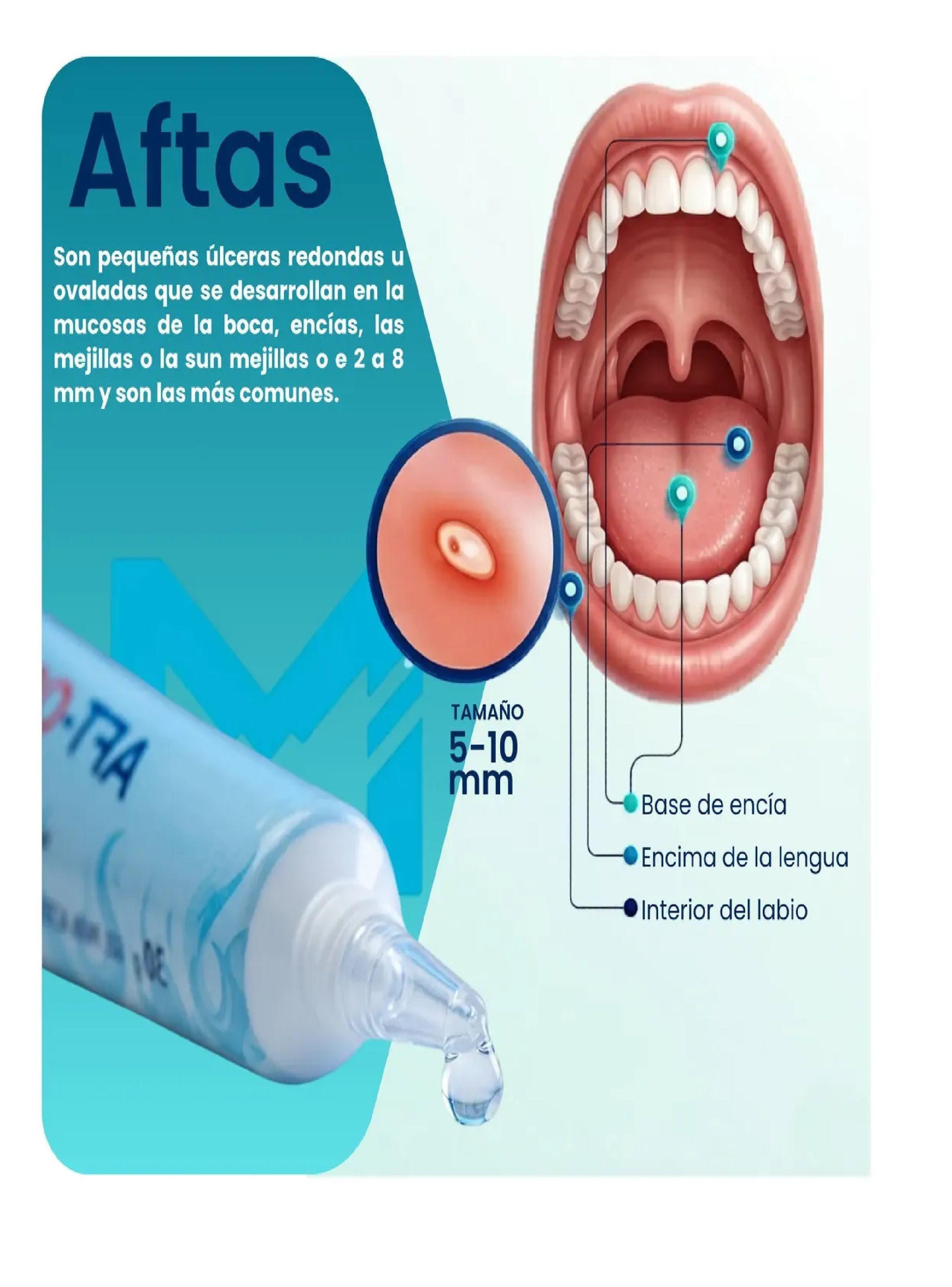 Pack 3 Unidades Aft Off Kids Gel Aftas Y Heridas Bucales 30g-2
