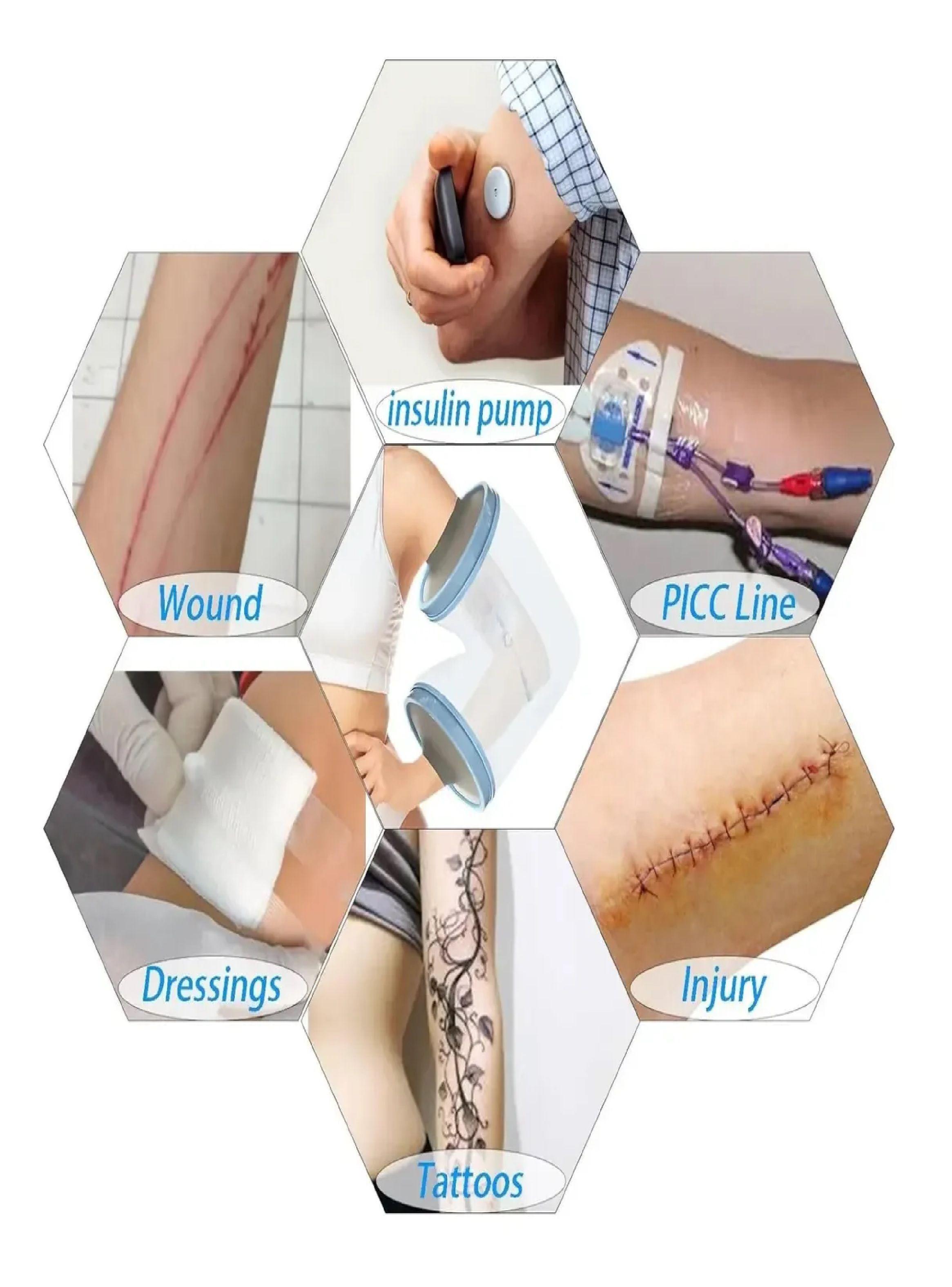 Protector Impermeable Para Brazo Vendaje Yeso Y Heridas-4