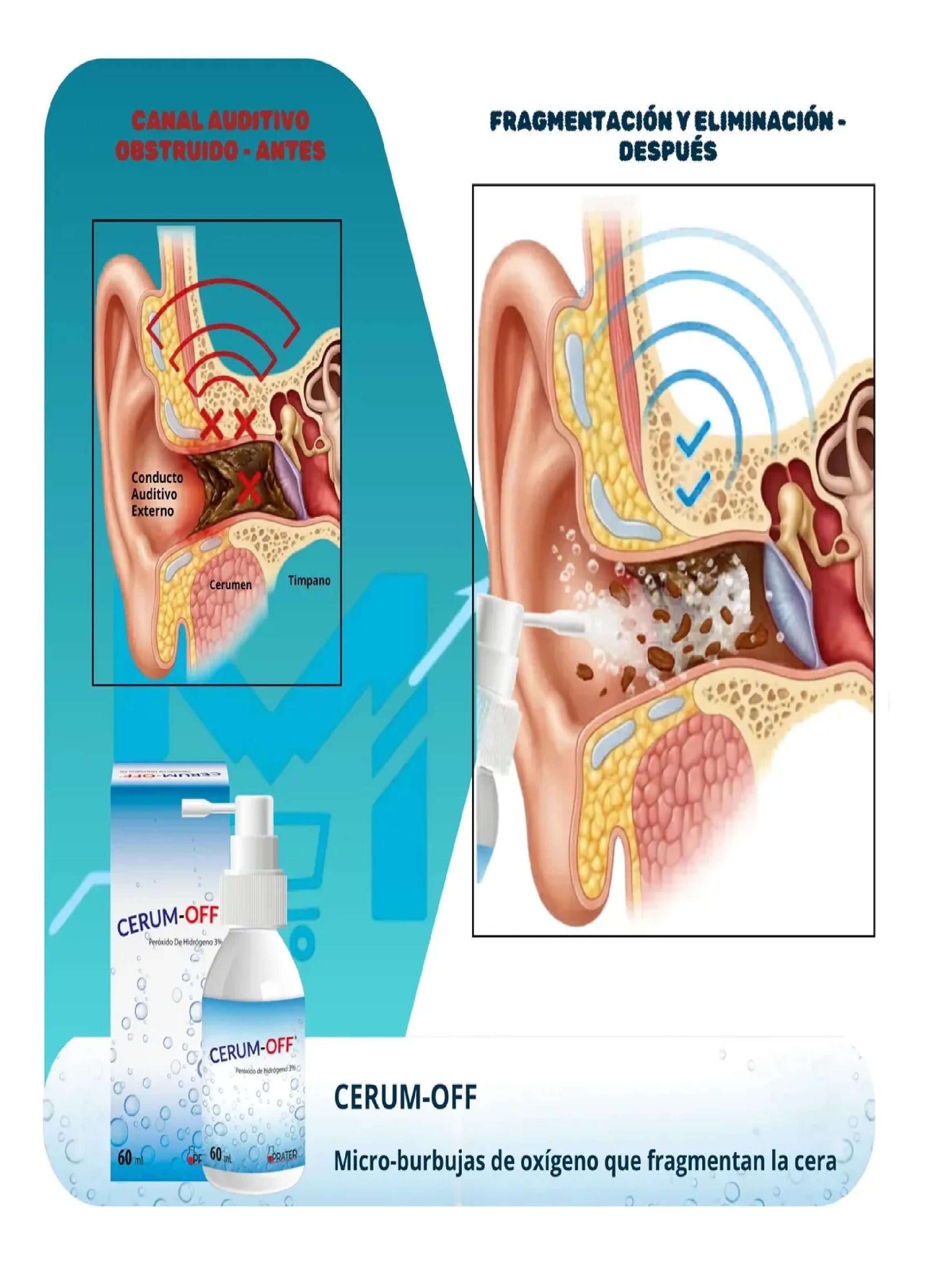 Pack X3 Cerum Off L quido Limpieza O dos Cerumen 60ml C u-4