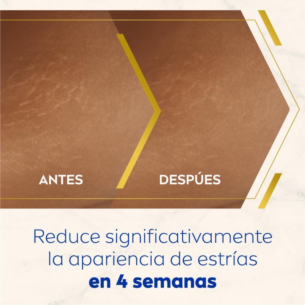NIVEA Luminous630® Serum Aceite Corporal Anti-estrías-6