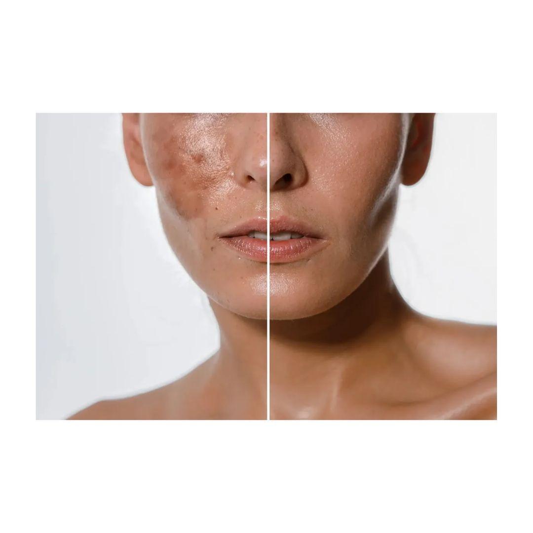 Crema facial de Tratamiento De Manchas Y Arrugas-2