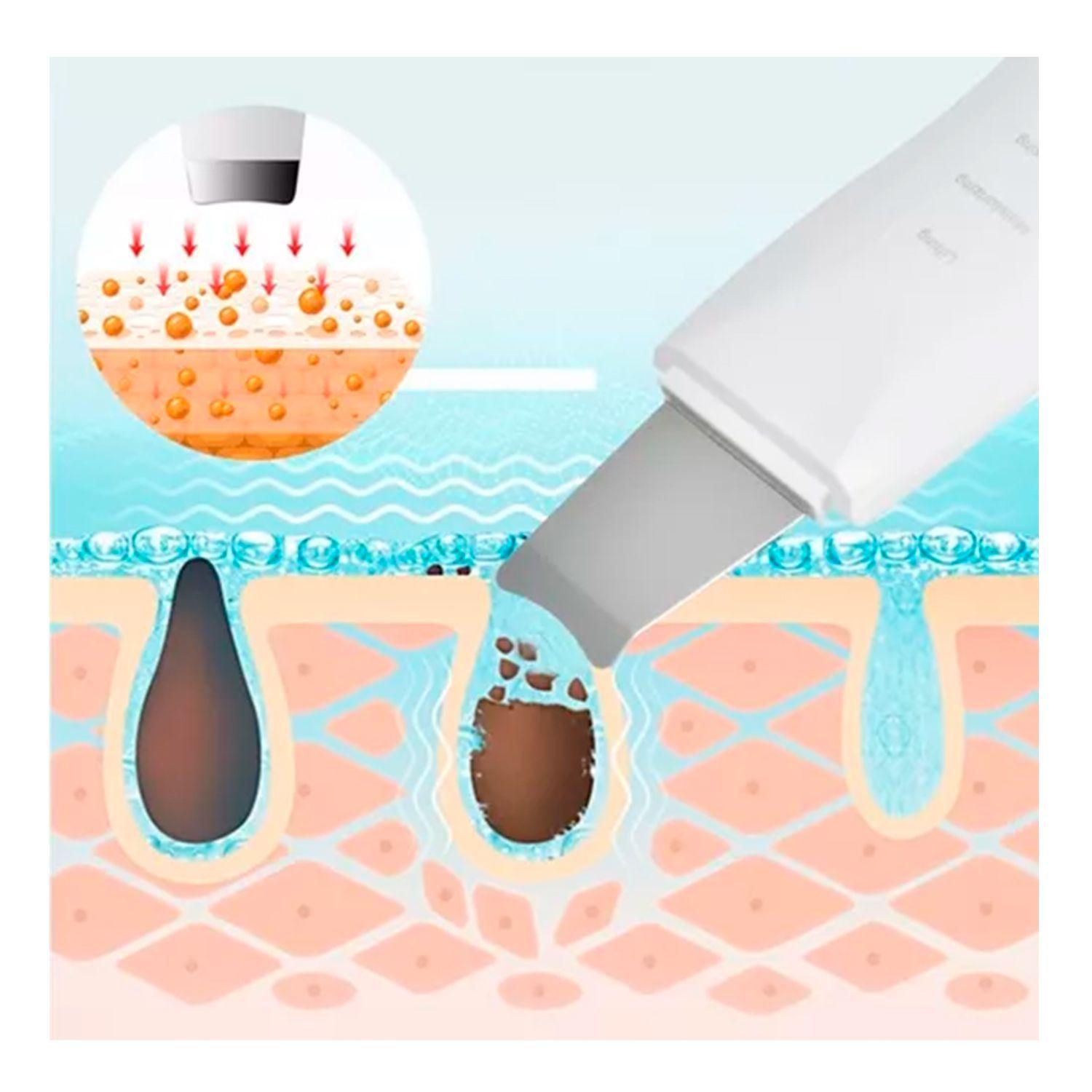 Paleta Peeling Ultrasonico Facial 3-1 + Set 7 Comedones-2