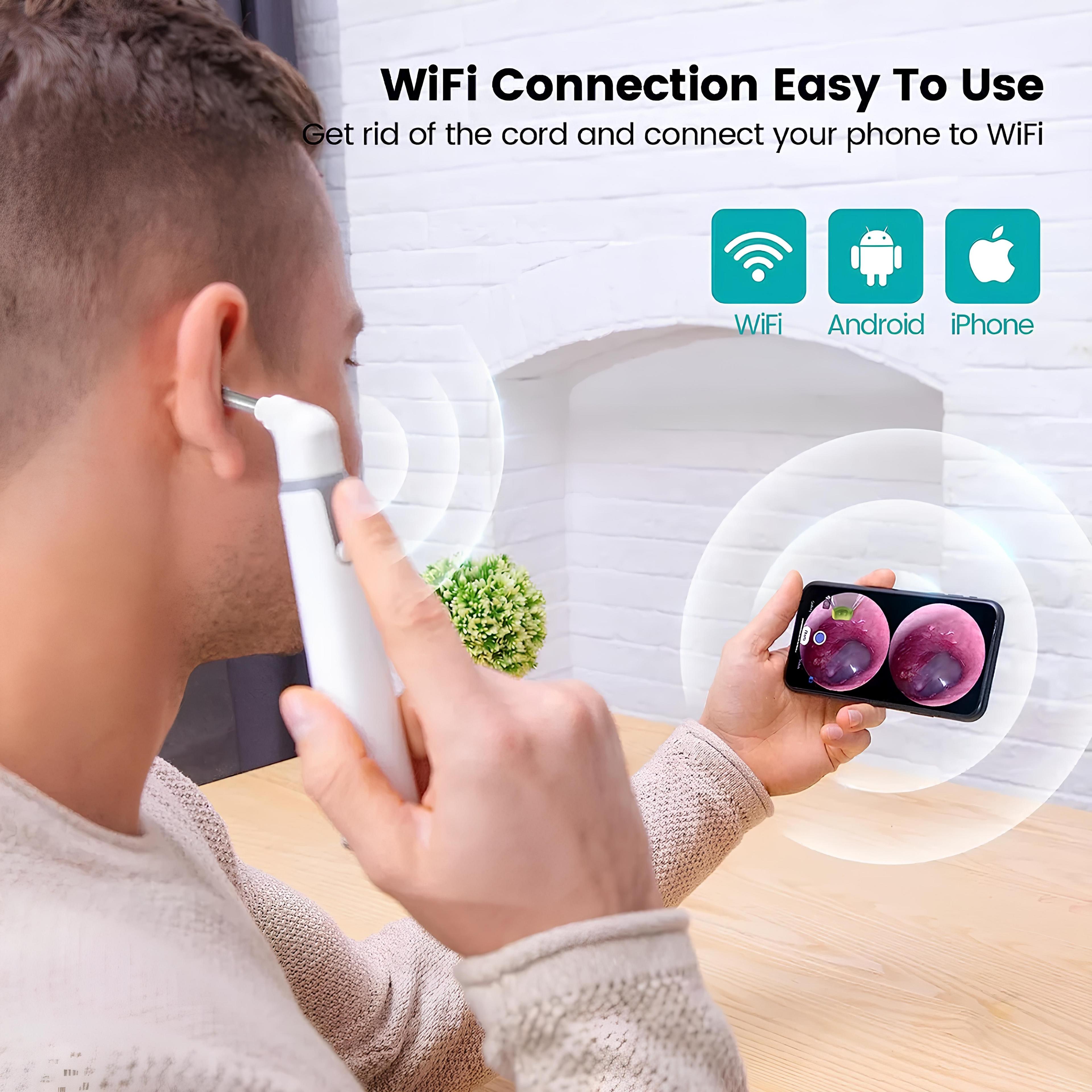 Otoscopio Inalámbrico Wifi Con Cámara De Oído -1