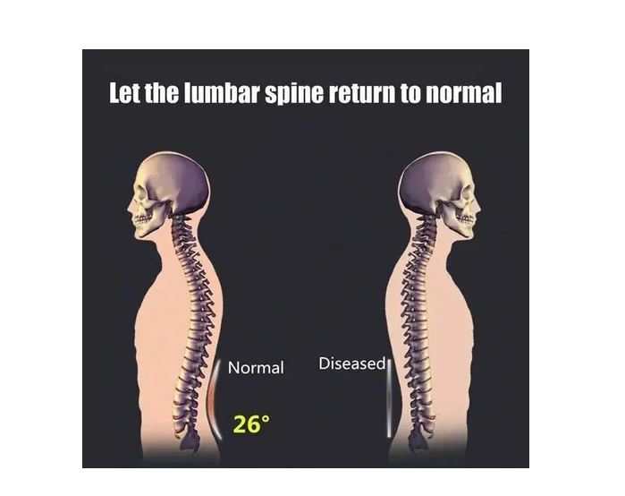 Soporte Masajeador Corrector Lumbar De Espalda Estiramiento-3