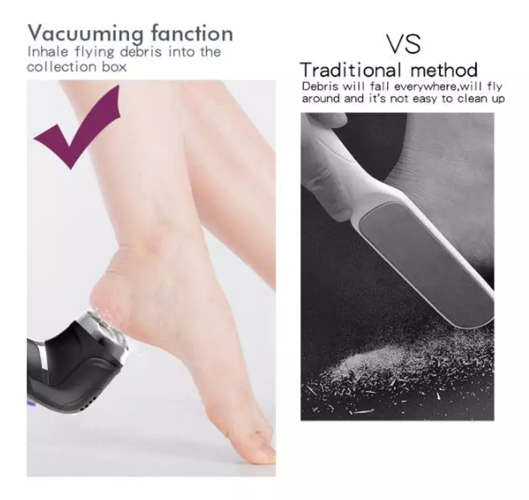 Eliminador de Callos Eléctrico USB Recargable Cabezas Intercambiables-9