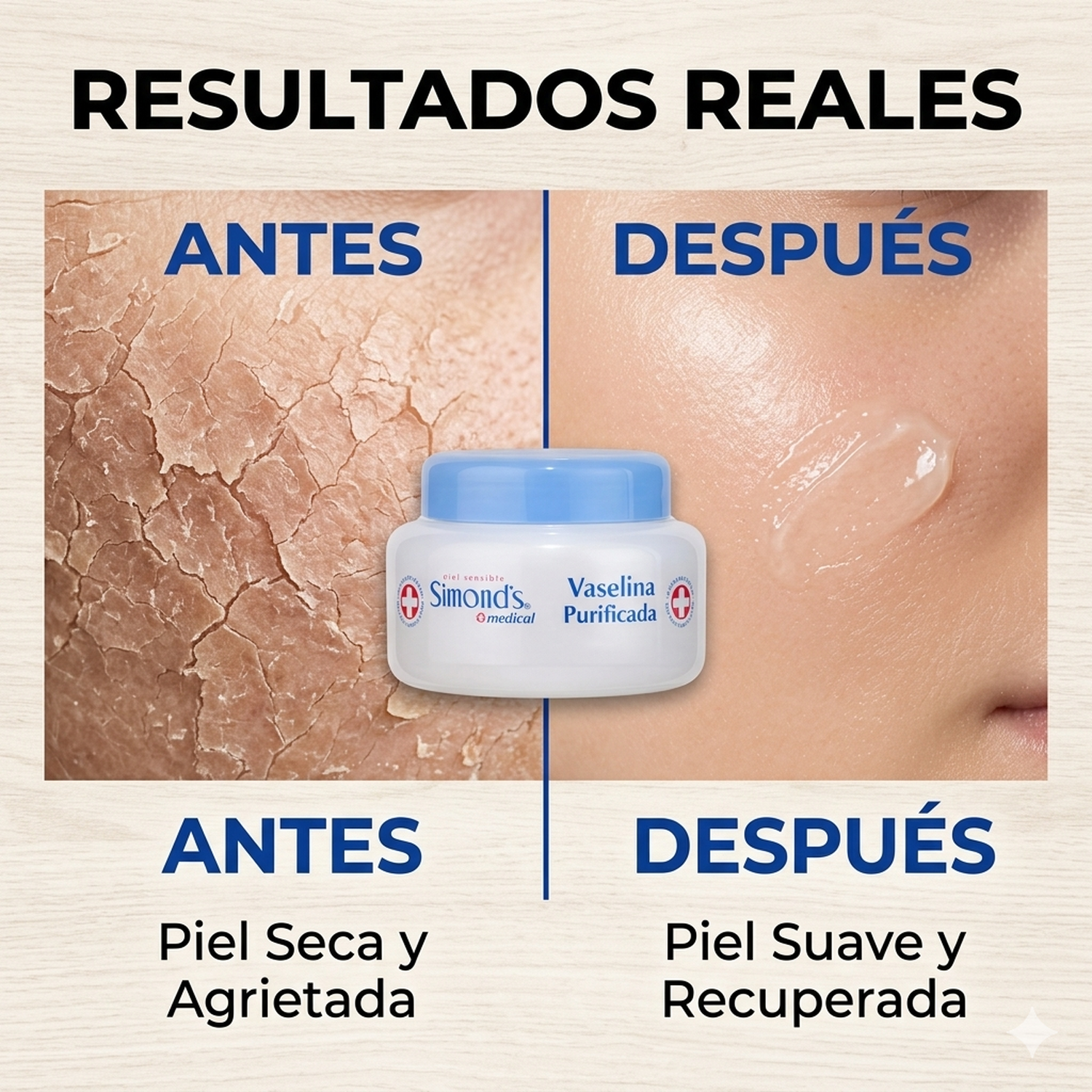 Vaselina Purificada Simonds Pote 110 Ml Protector Dérmico-2