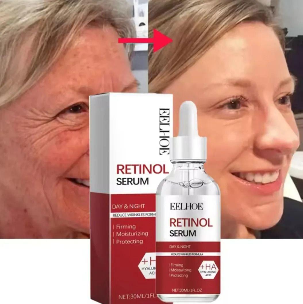 Retinol Serum Acido Hialuronico Pigmento Suavizante Facial-3
