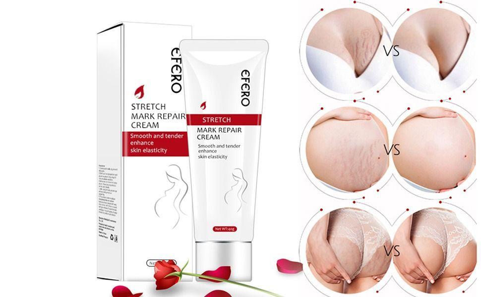 Crema Efero Reafirmante Elimina Cicatrices Estrias Embarazo-2