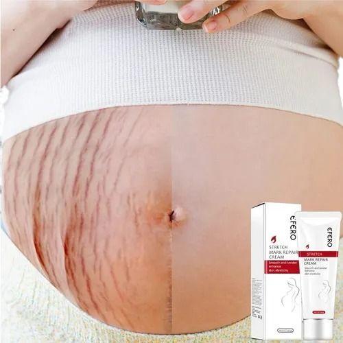 Crema Efero Reafirmante Elimina Cicatrices Estrias Embarazo-4