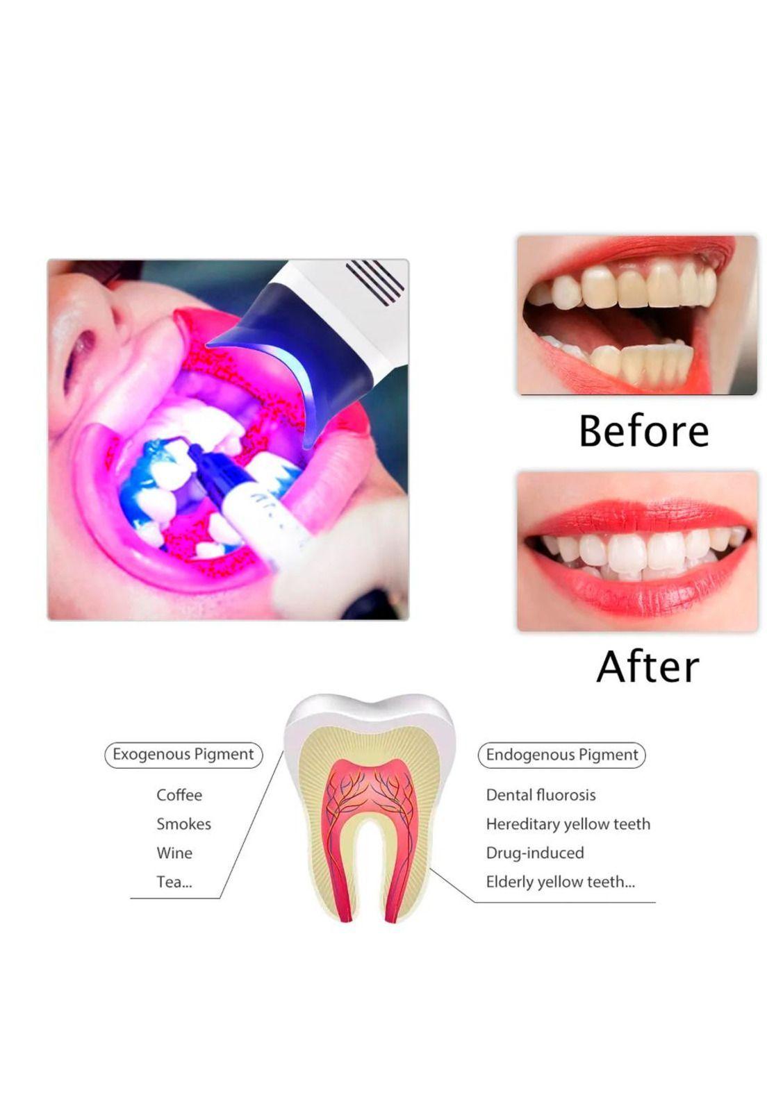 Lámpara Aceleradora De Blanqueamiento Dental De Pedestal-7