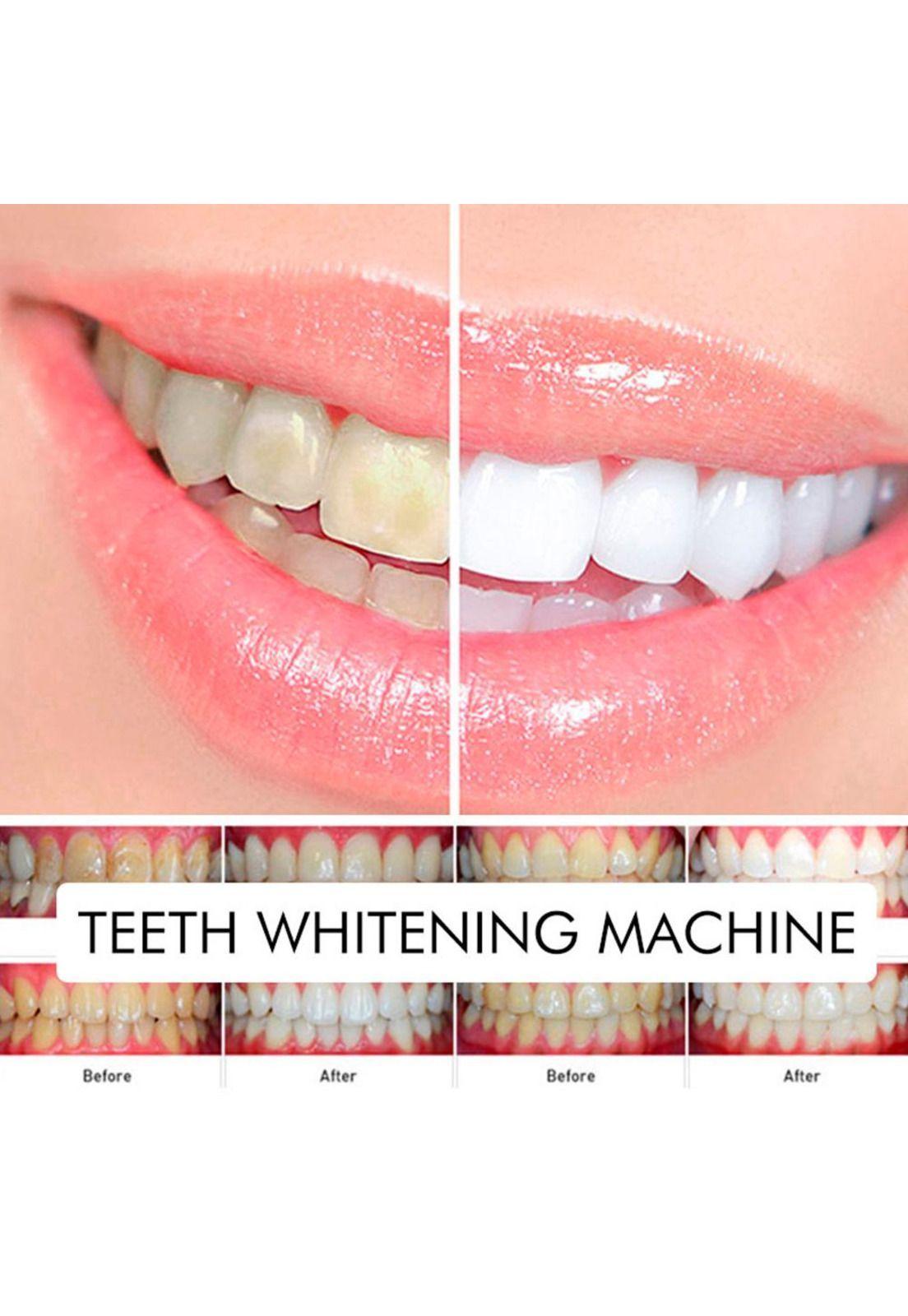 Lámpara Aceleradora Blanqueamiento para sillón-3