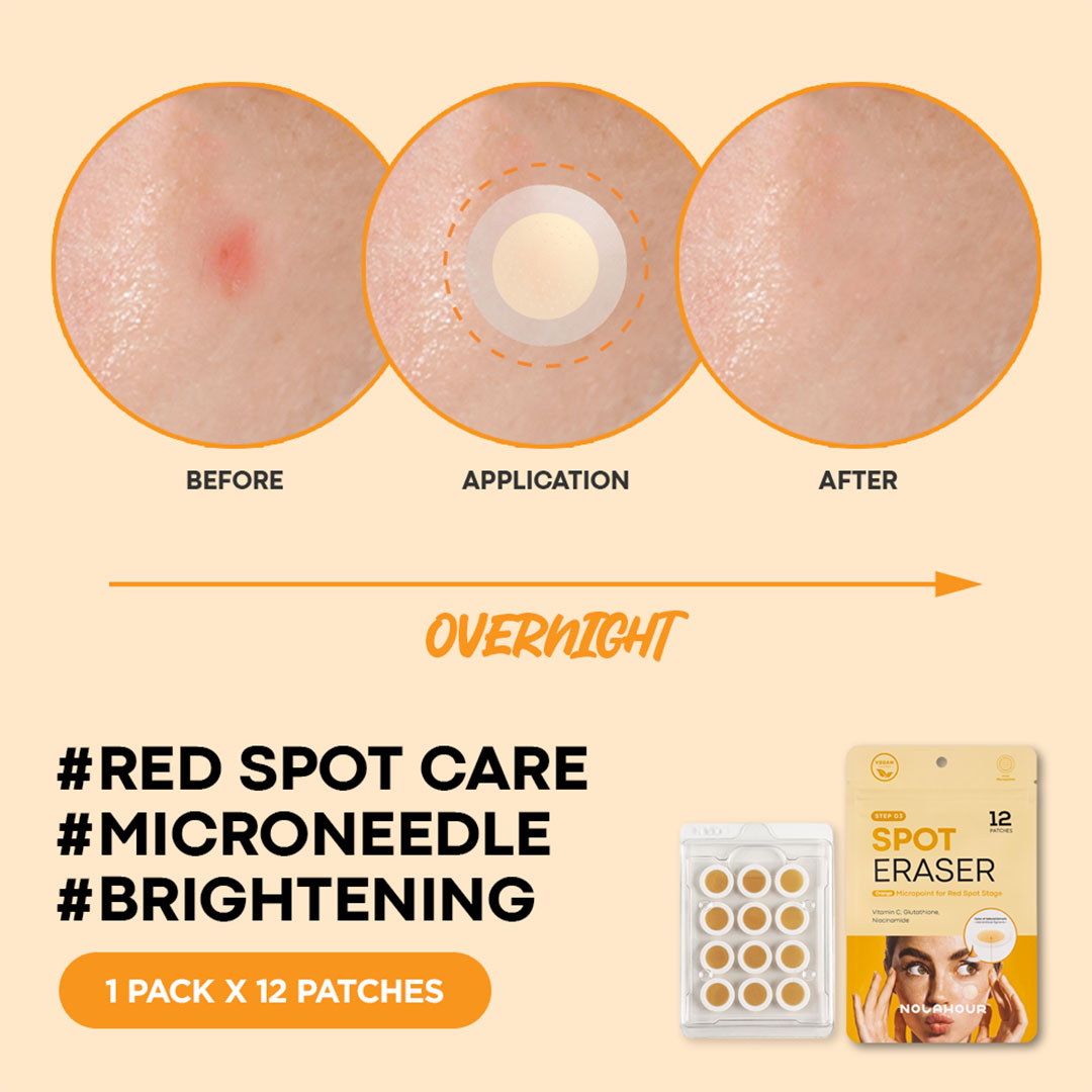 Parches para manchas 12 un-5