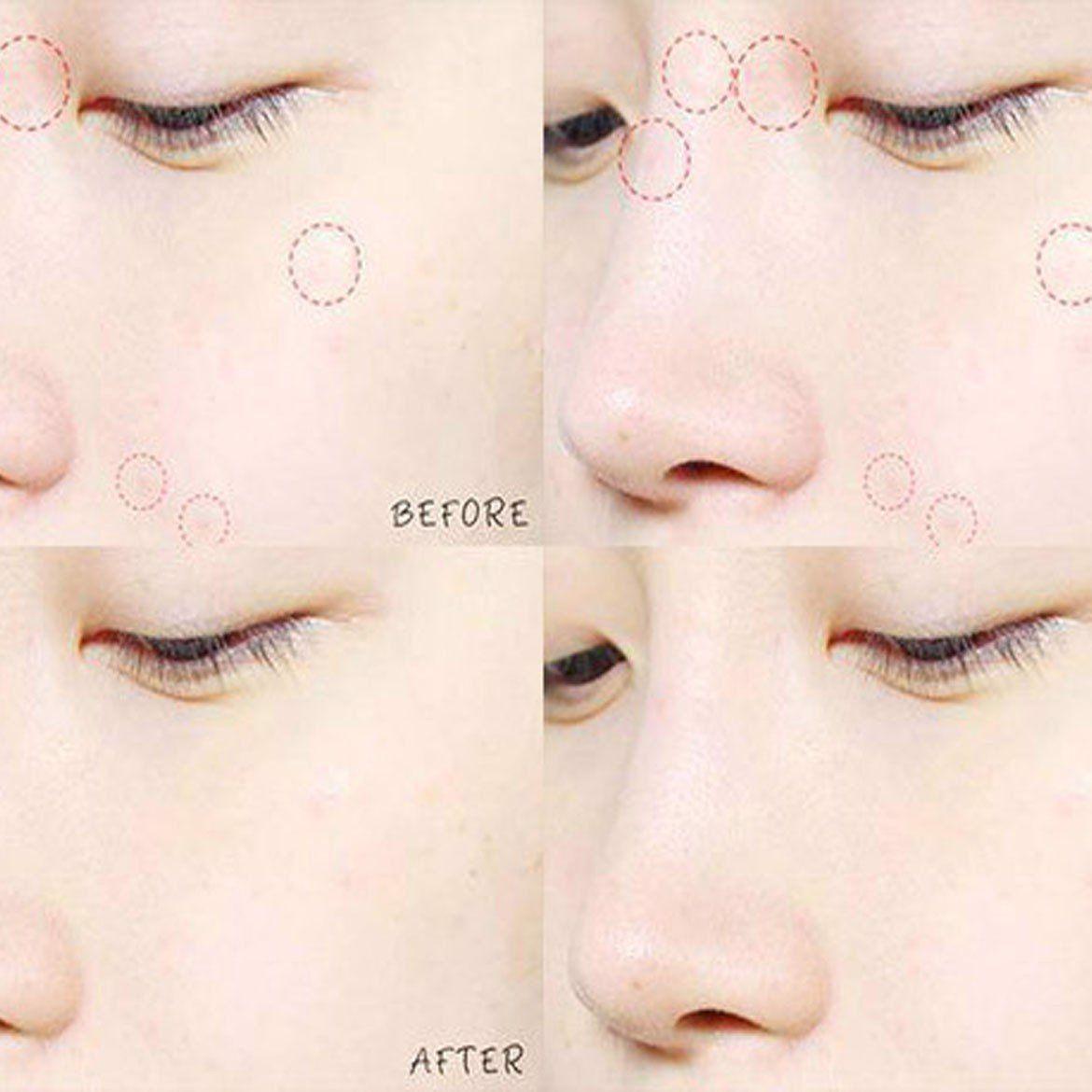 The Saem Parches See Saw A C Control Clear Spot Patch-3