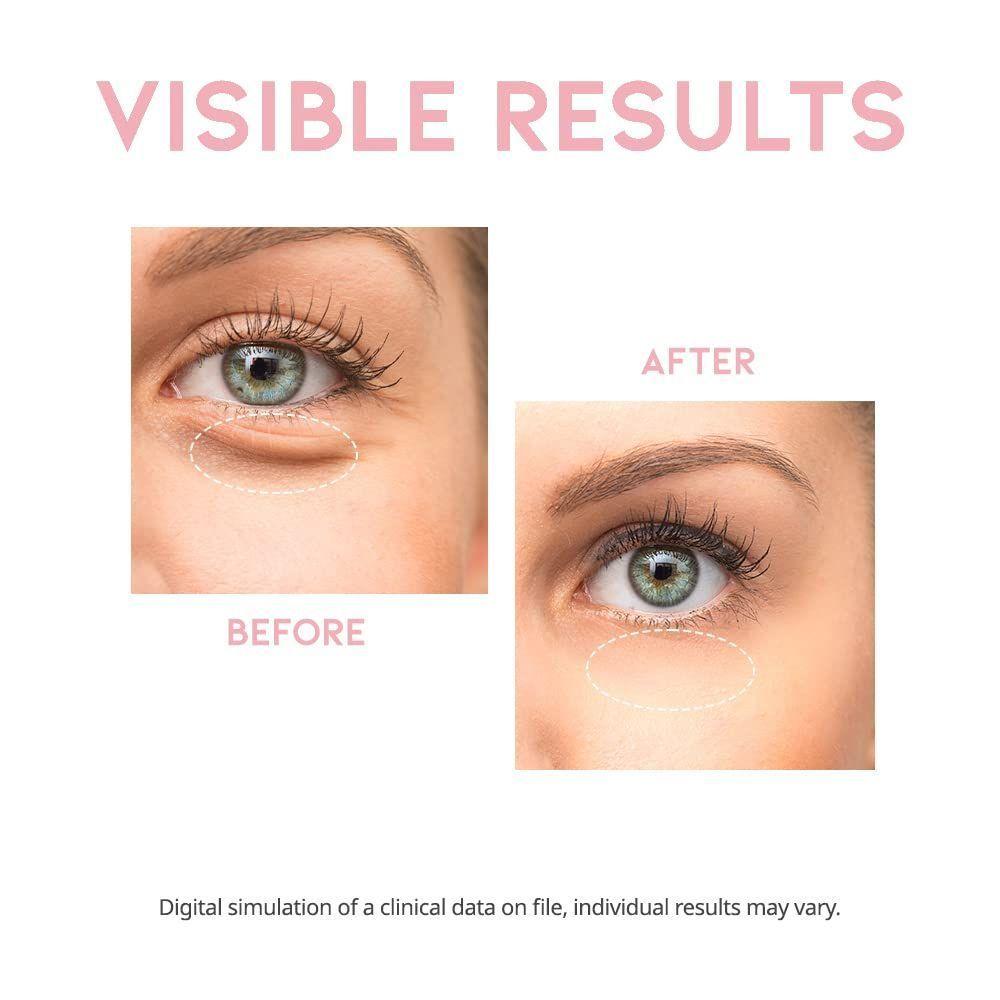 Serum Contorno De Ojos reducir la hinchaz n Depuff-4