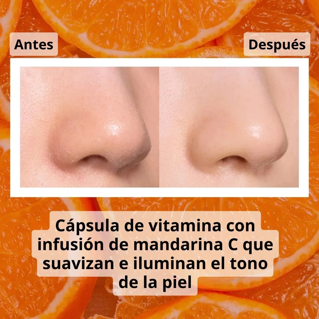 Banila Exfoliante Clean it Zero Brightening Peeling Gel-4