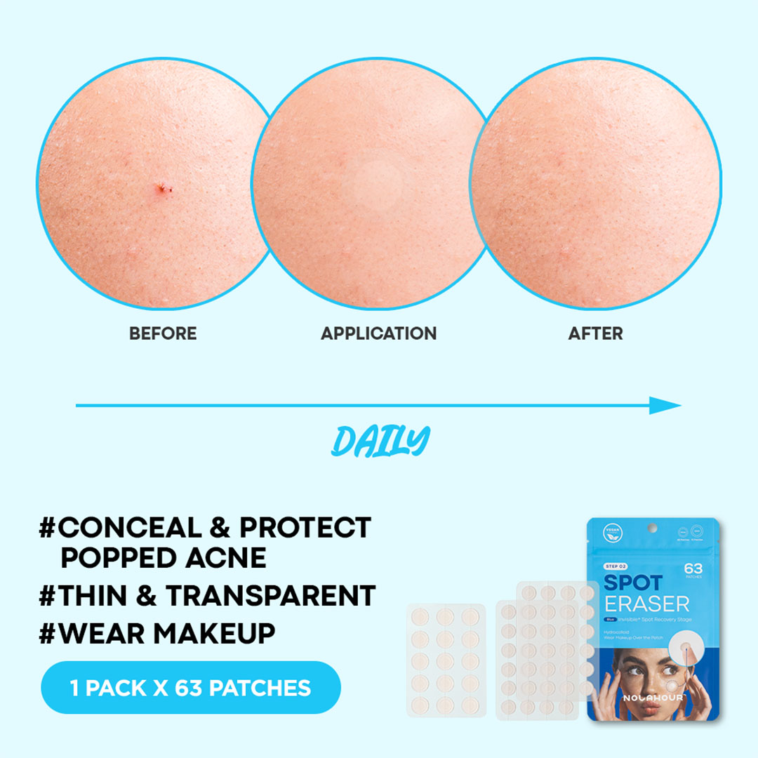 Parches para espinillas 63 parches-7