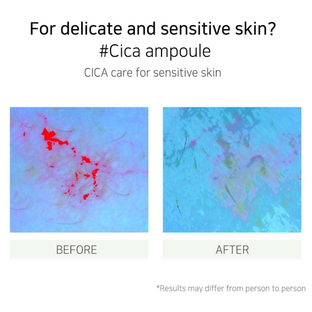 Muldream Ampolla Vegan green mild CICA ampoule-4