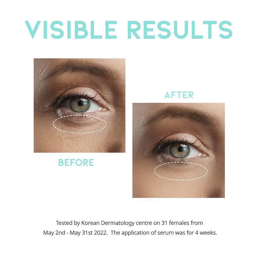 Serum Antiarrugas Contorno Ojos-4