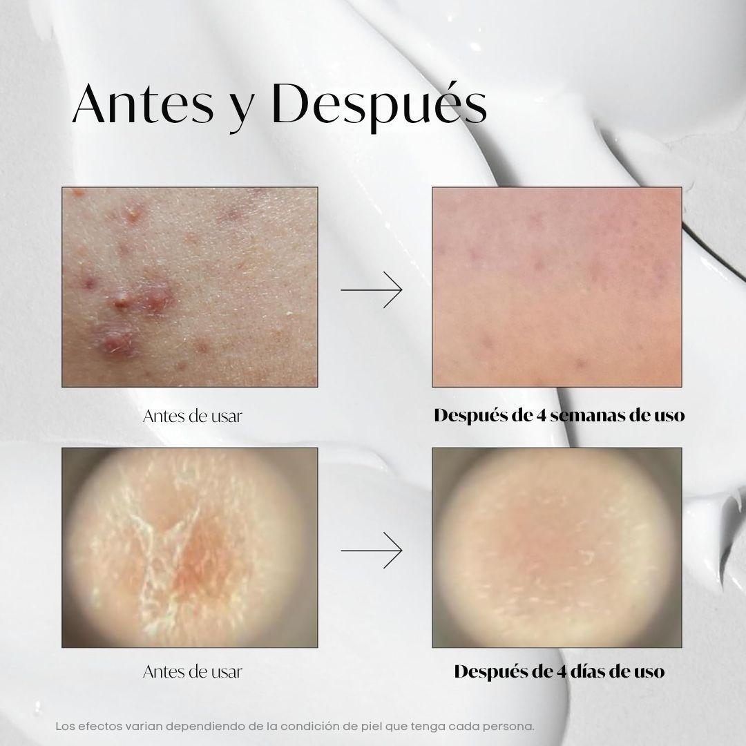 Serum coreano de microagujas VT Cosmetics Reedle Shot 100-4