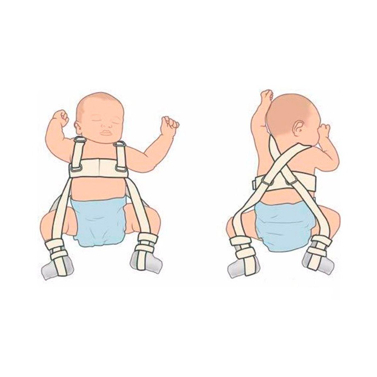 Correas Pavlik Displasia De Cadera Para Niños Talla S-6