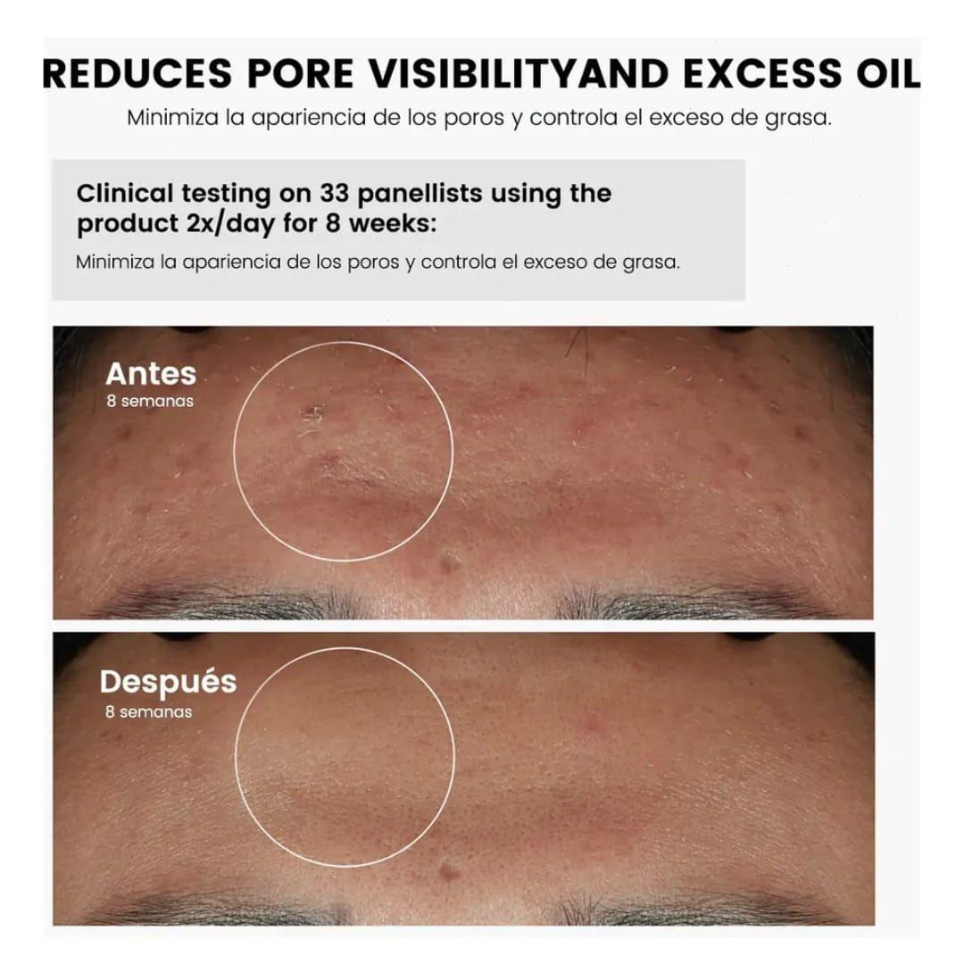 NIACINAMIDE 10 ZINC 1 ENJOY SKIN 30 ML-2