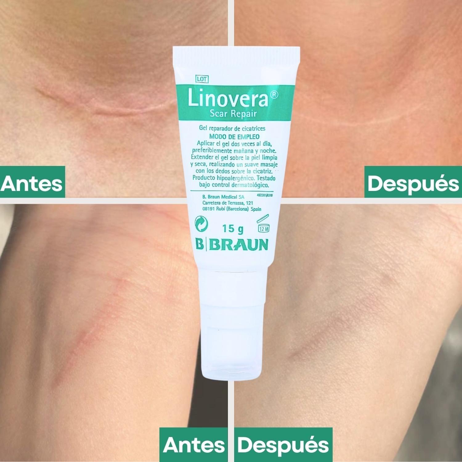 Linovera Scar Repair Gel Reparador De Cicatrices-2