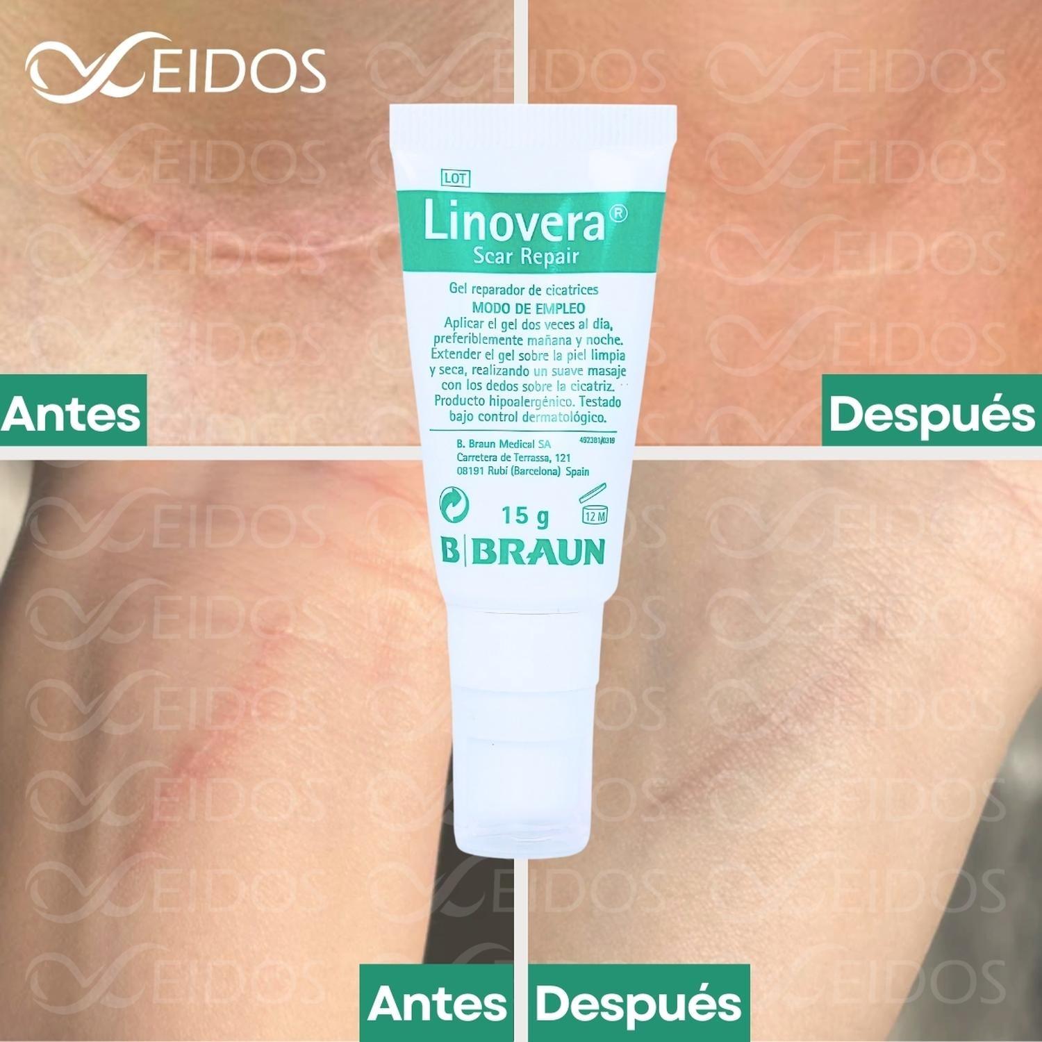 Linovera Scar Repair Gel Reparador De Cicatrices-3