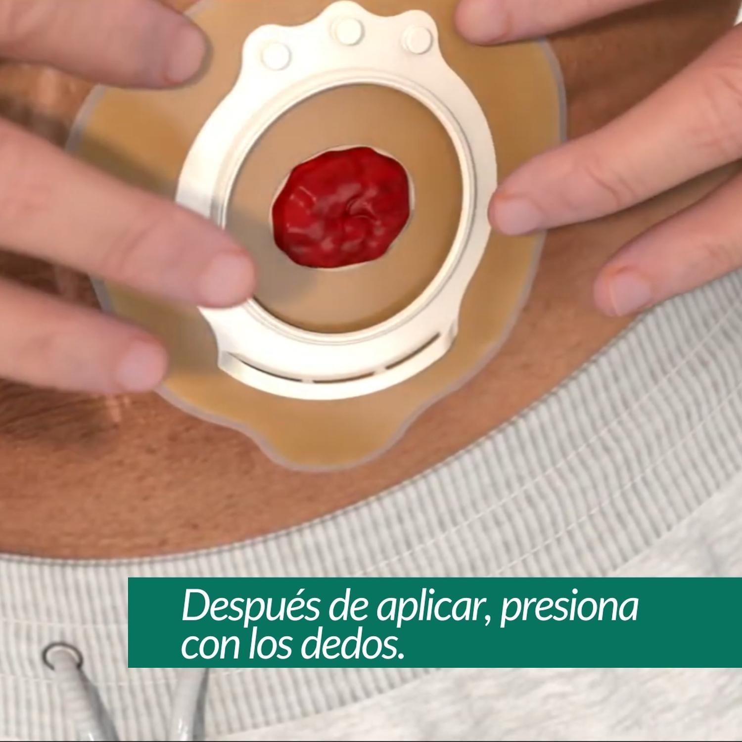 Pasta de Ostomía Sin Alcohol B Braun 80g-5