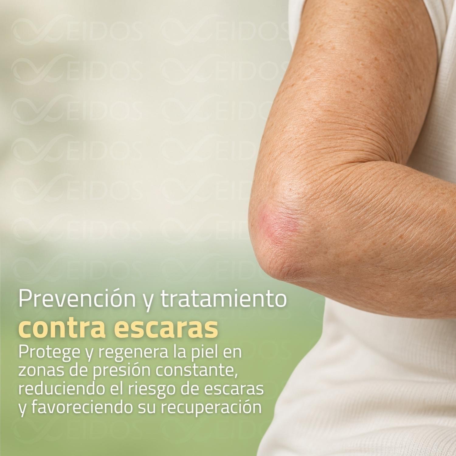 Linocare 30 ml Protector Cutaneo Aceite para Cicatrices-3