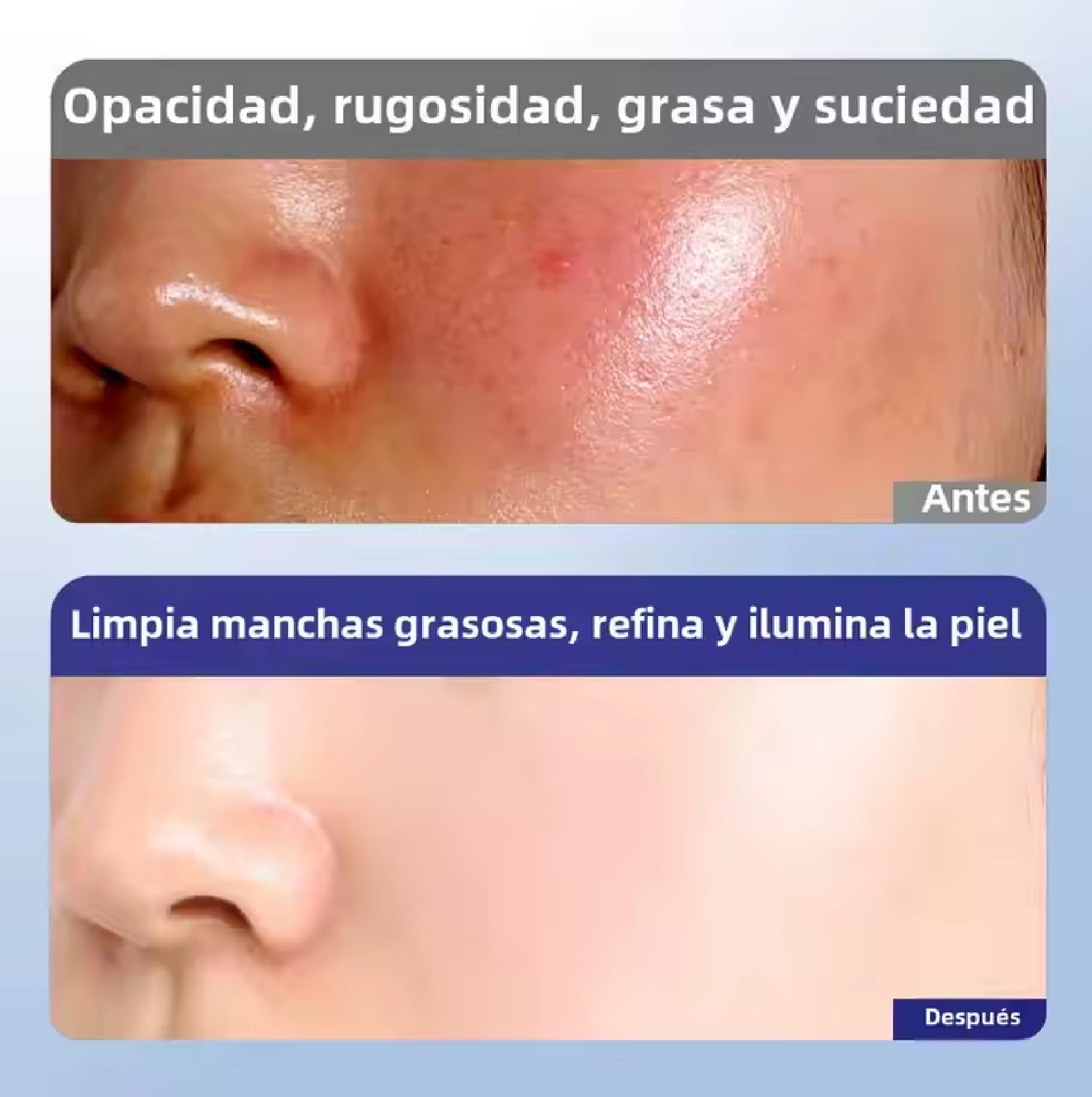 Set Skincare Vitamina E-3