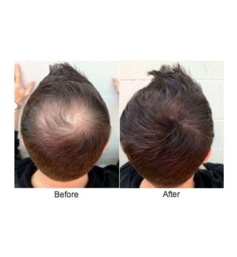 Texturizador Capilar-2