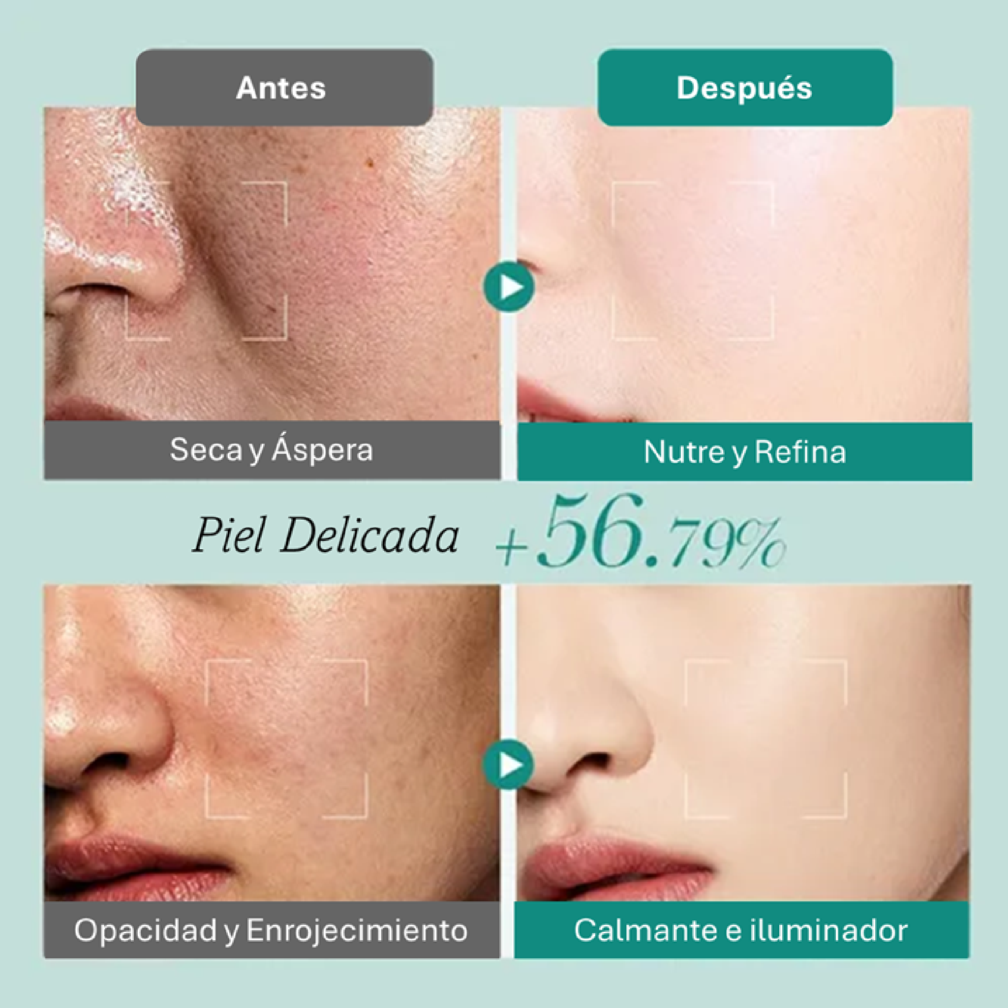 Set Skincare Acido Hialuronico-4