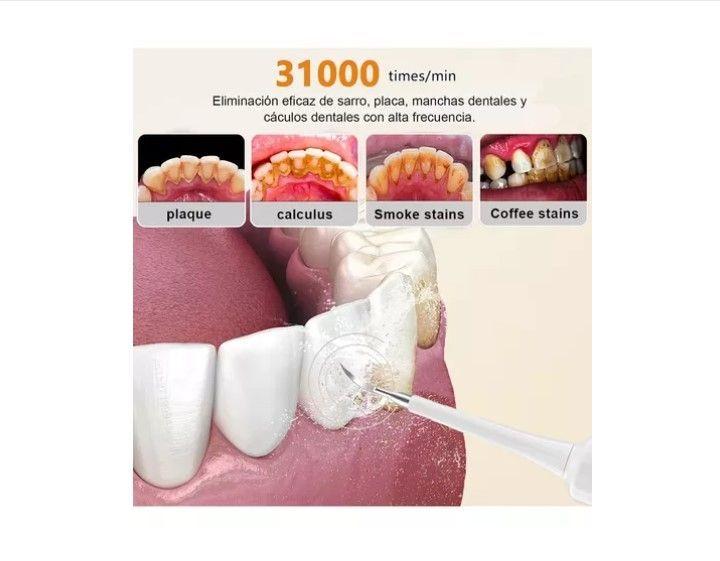 Kit Cepillo Limpiador Dental Eléctrico Ultrasónico Removedor-4