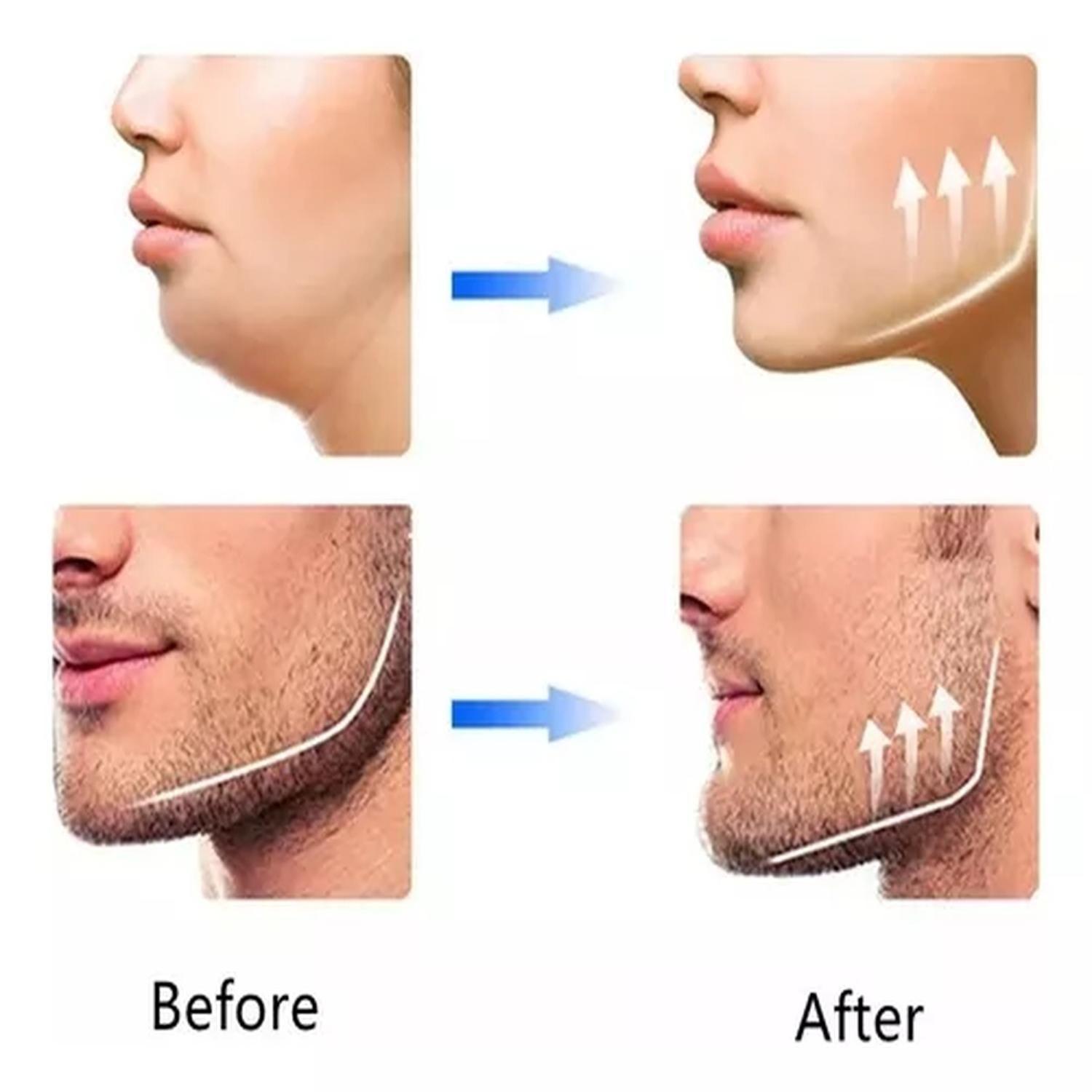 Ejercitador Refirmante Mandibula Modela Musculatura Cara-3