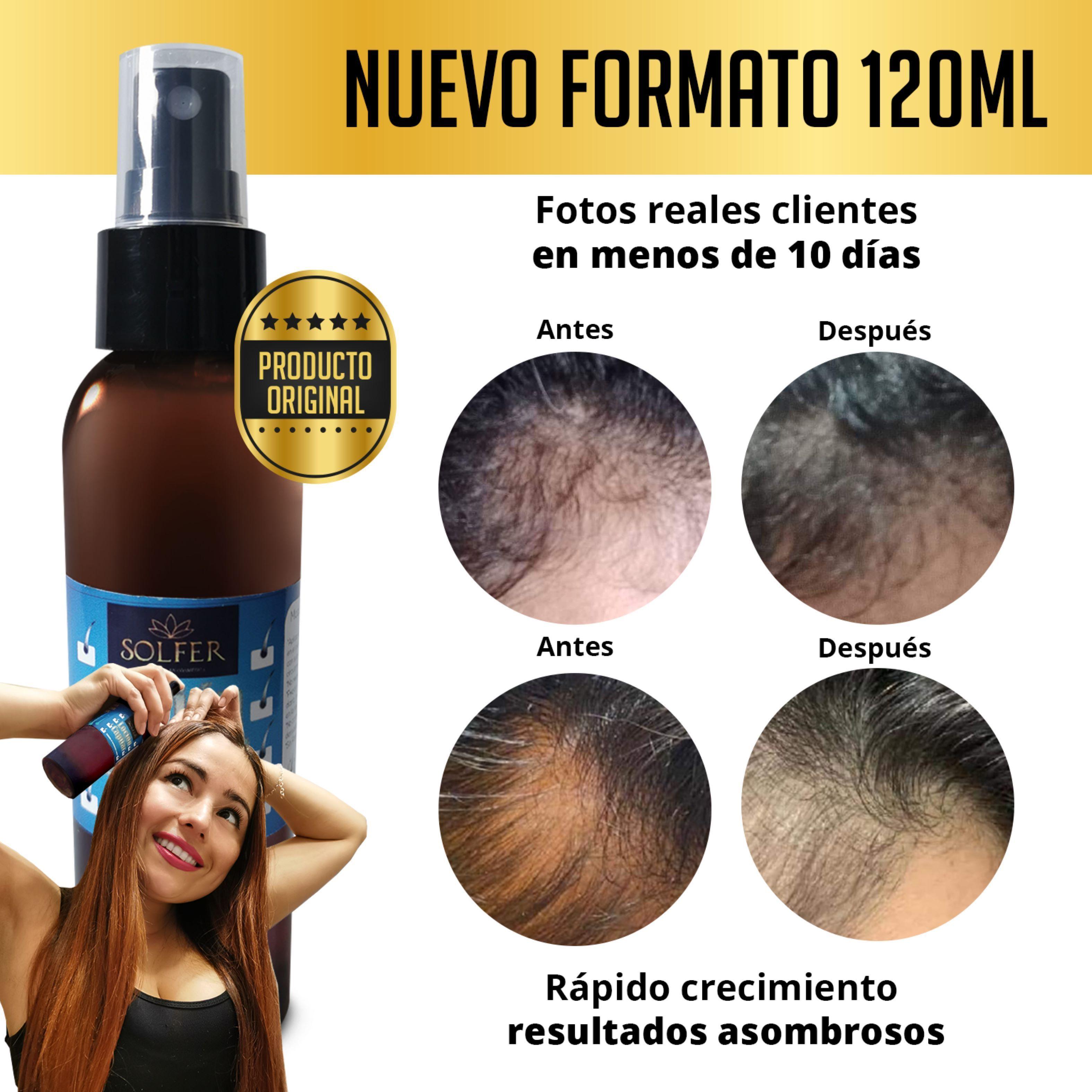 spray para el crecimiento del cabello-1