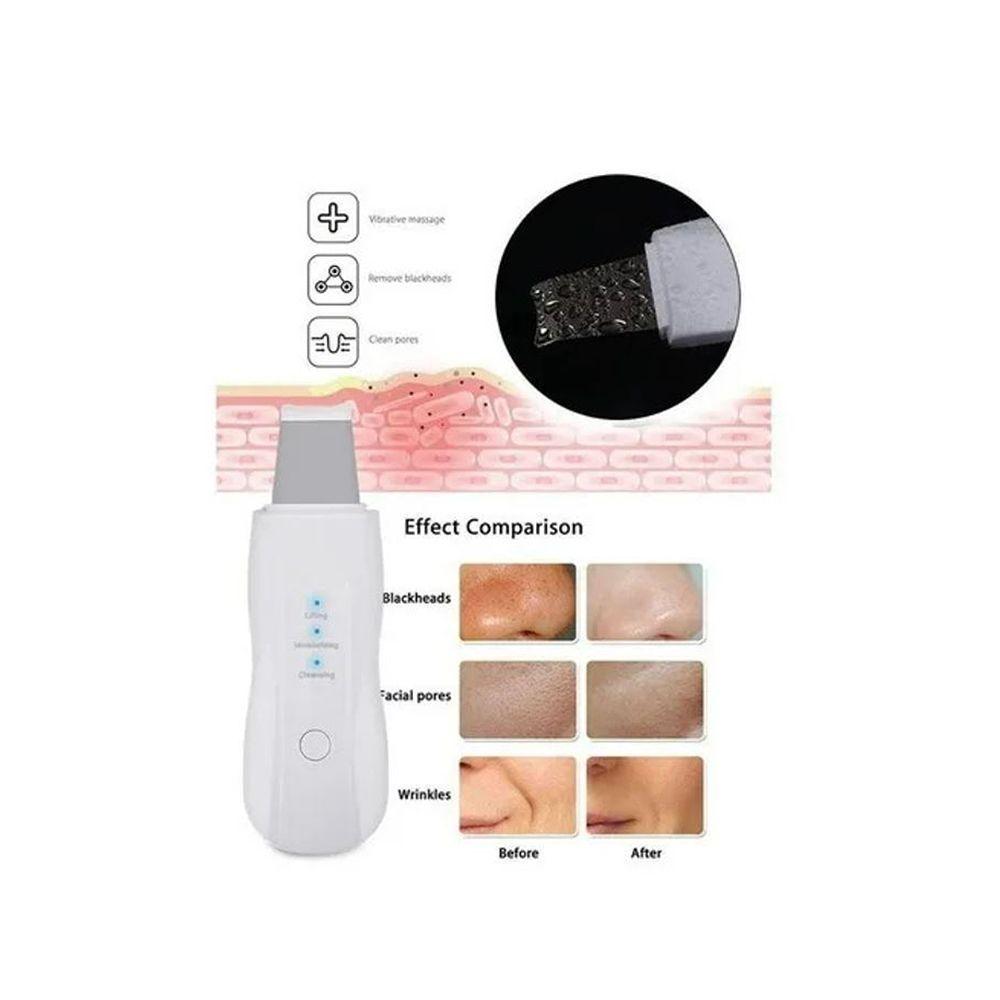 Limpiador Facial Espatula Saca Puntos Negro Exfoliante-1