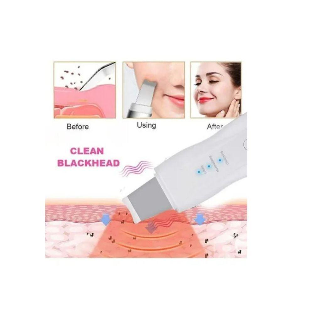 Limpiador Facial Espatula Saca Puntos Negro Exfoliante-2