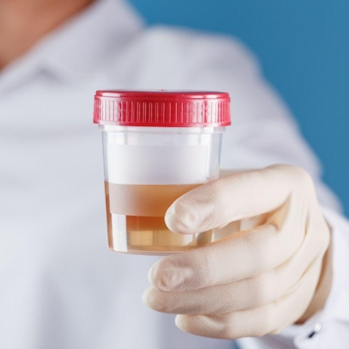 PAQUETE RECOLECTOR DE HECES MUESTRA LABORATORIO LAU-2