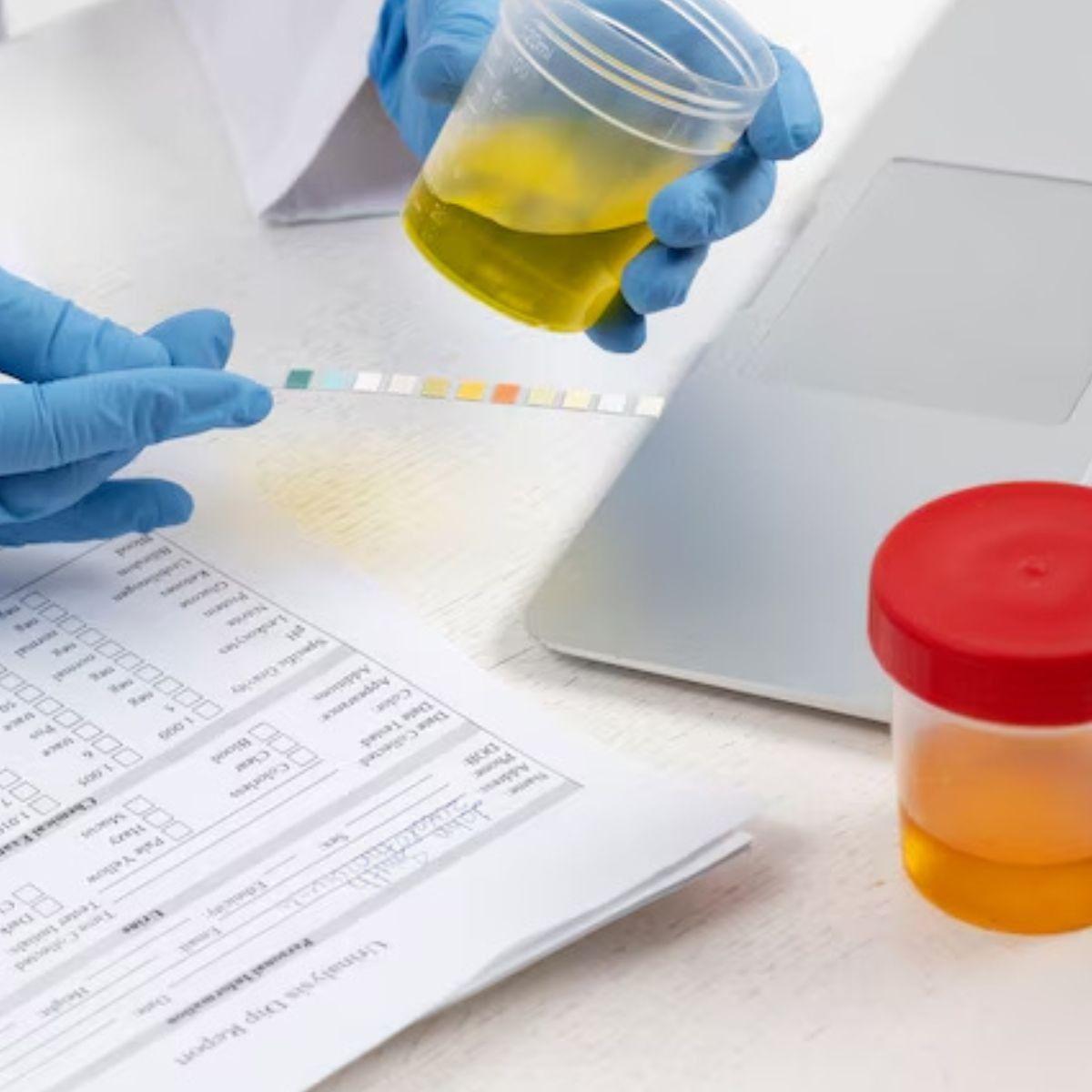 PAQUETE RECOLECTOR DE HECES MUESTRA LABORATORIO LAU-6