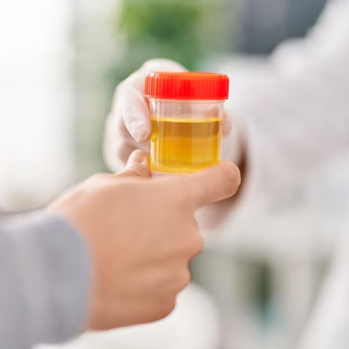 PAQUETE RECOLECTOR DE HECES MUESTRA LABORATORIO LAU-8