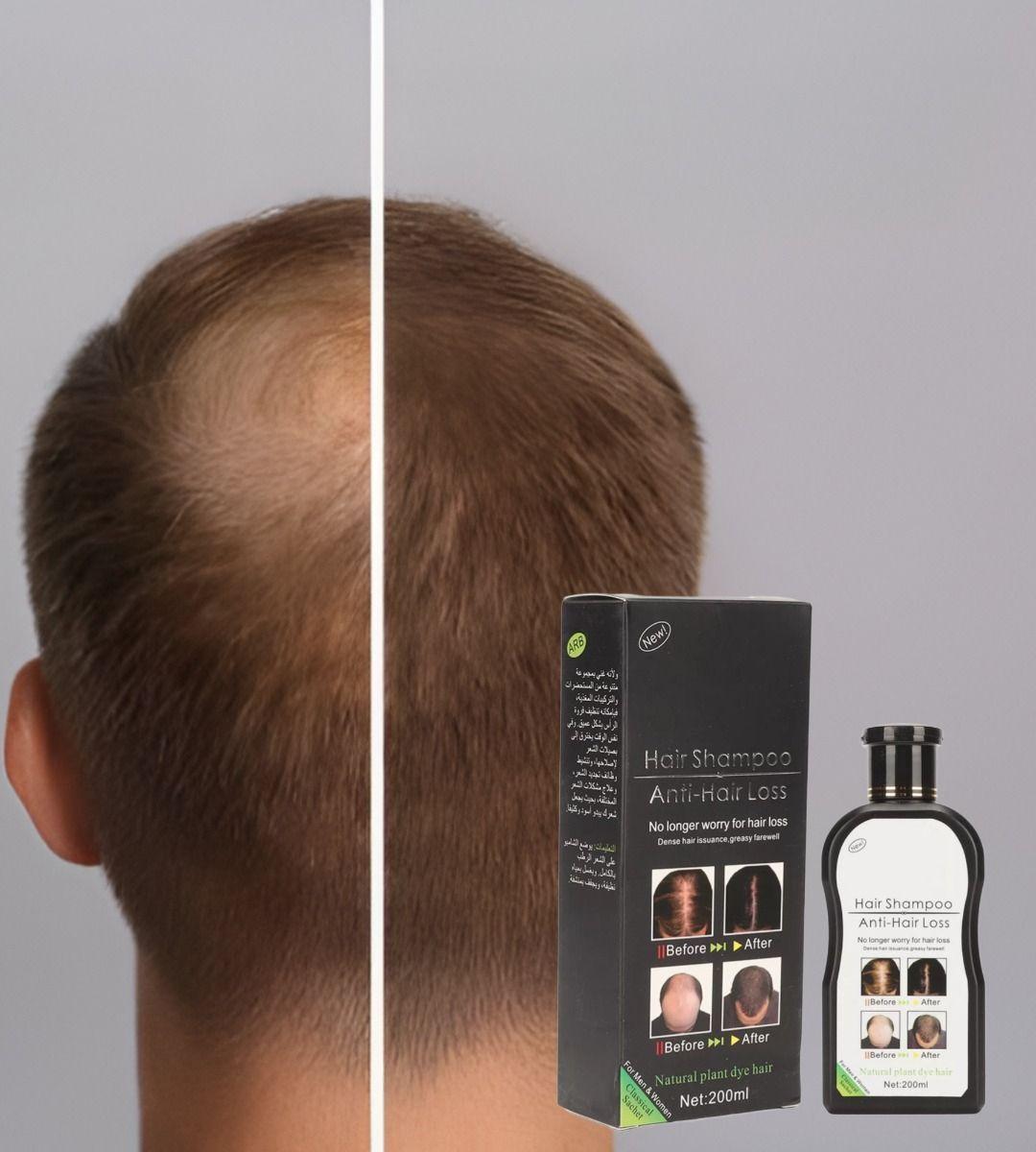 Set 2 Shampoo Anticaida Cabello Crecimiento Voluminoso Jhn-2